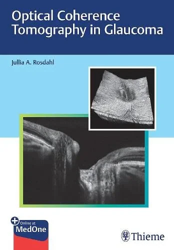 Coperta cărții "Optical Coherence Tomography in Glaucoma" de Jullia Rosdahl
