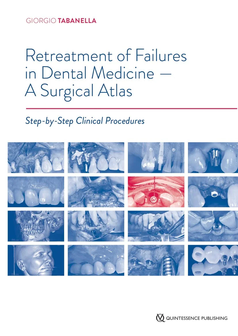 Coperta cărții "Retreatment of Failures in Dental Medicine - A Surgical Atlas: Step-by-Step Clinical Procedures" de Tabanella, Giorgio