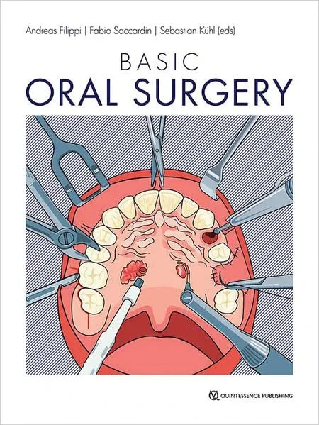 Coperta cărții "Basic Oral Surgery" de Filippi