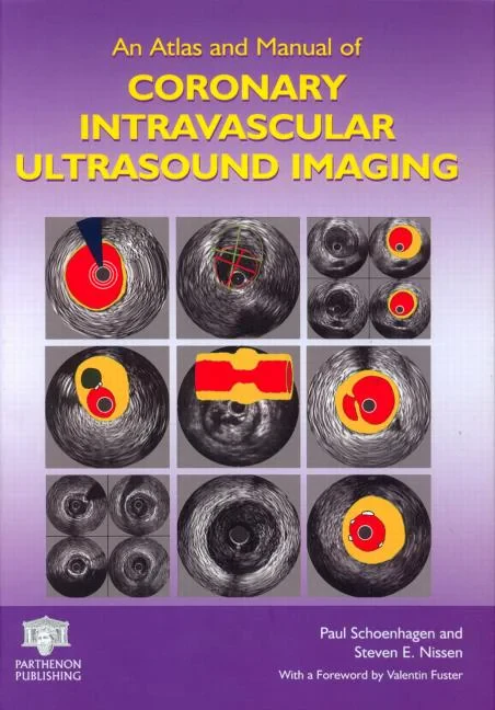 An Atlas and Manual of Coronary Intravascular Ultr...