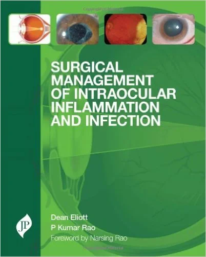 Coperta cărții "Surgical Management of Intraocular Inflammation and Infection" de Dean Eliott