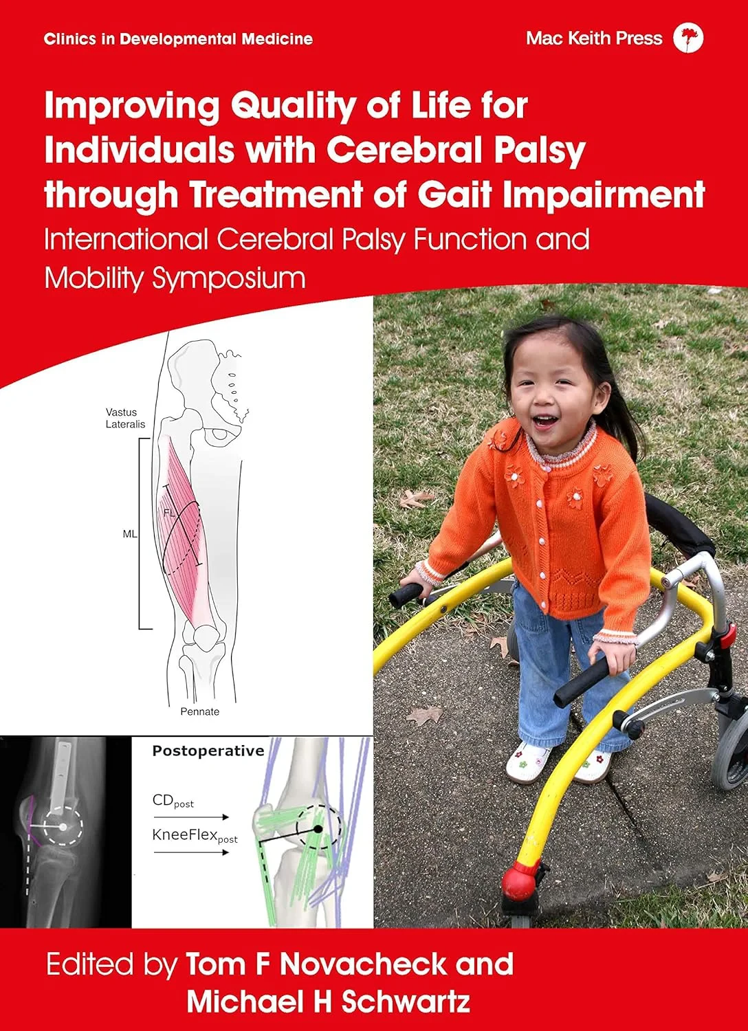 Coperta cărții "Improving Quality of Life for Individuals with Cerebral Palsy through Treatment of Gait Impairment: International Cerebral Palsy Function and Mobility" de Tom F. Novacheck (Editor), Michael H. Schwartz (Editor)