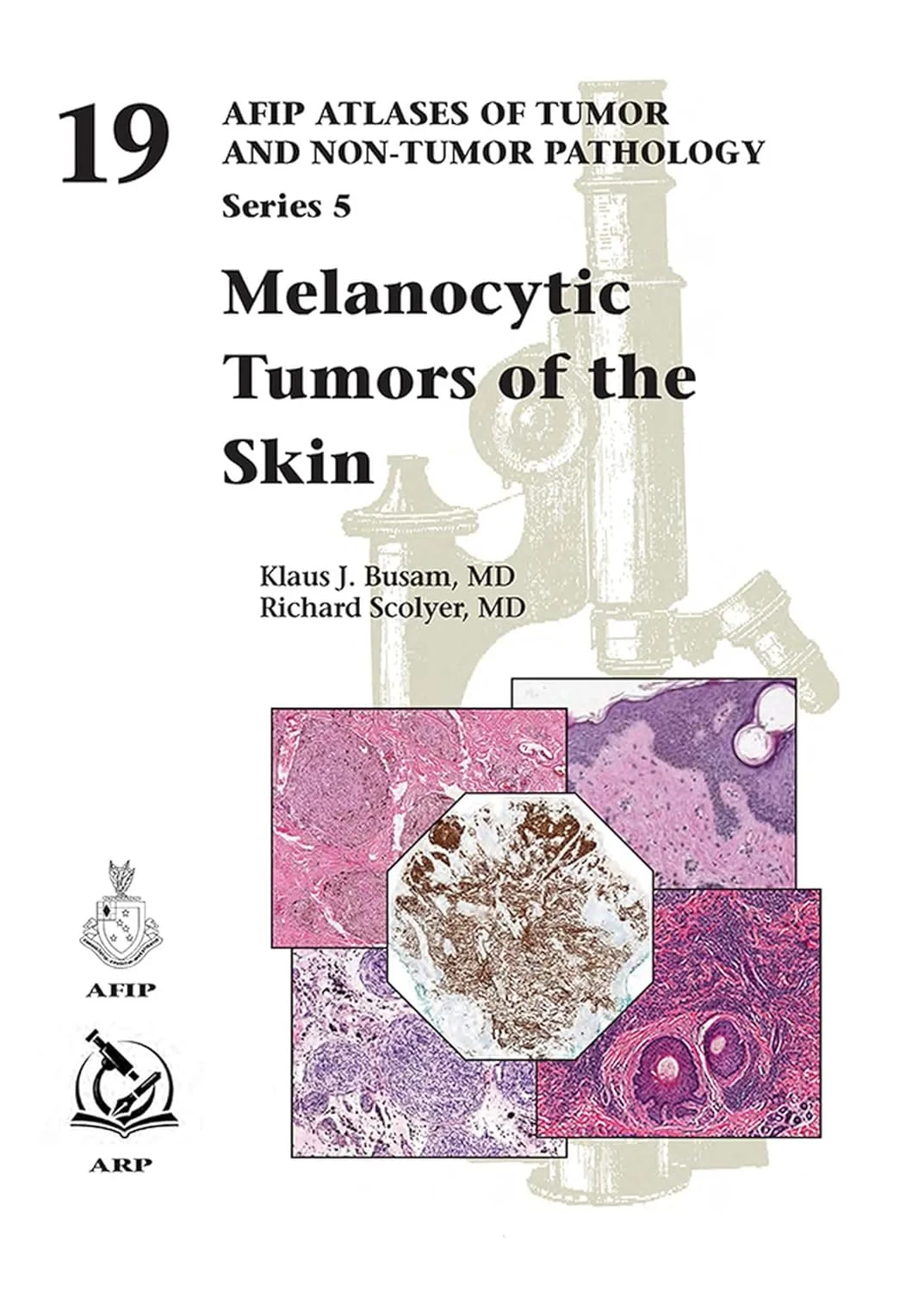 Melanocytic Tumors of the Skin. AFIP Atlases of Tu...