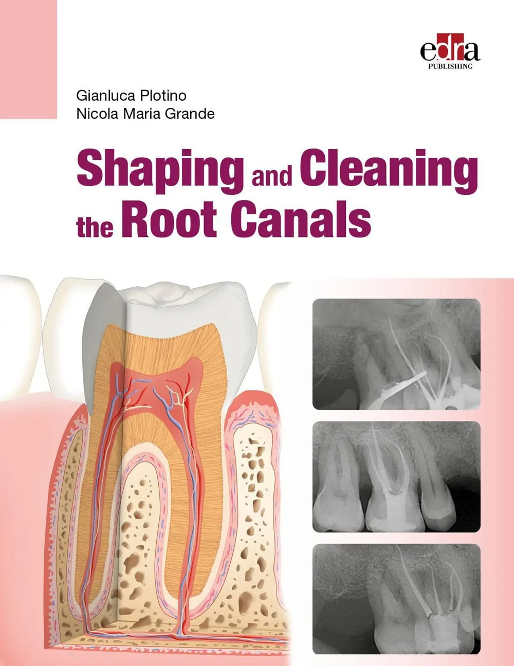 Coperta cărții "Shaping and Cleaning the Root Canal System" de autor necunoscut