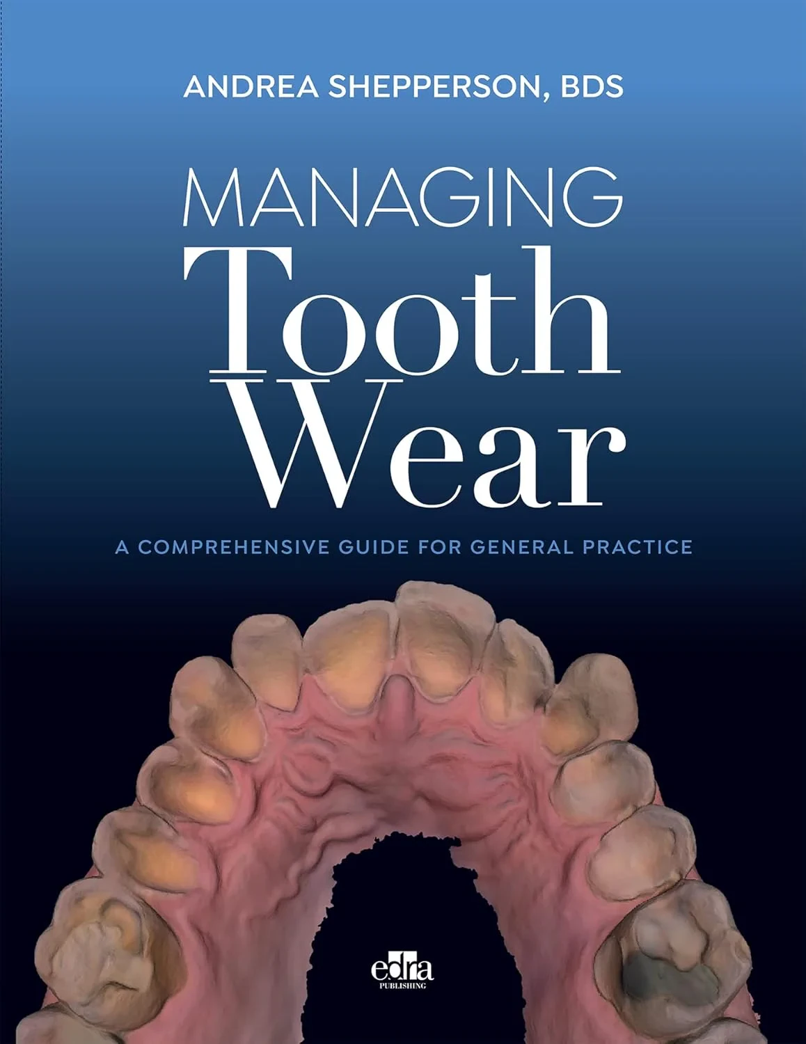 Managing Tooth Wear: A comprehensive guide for gen...