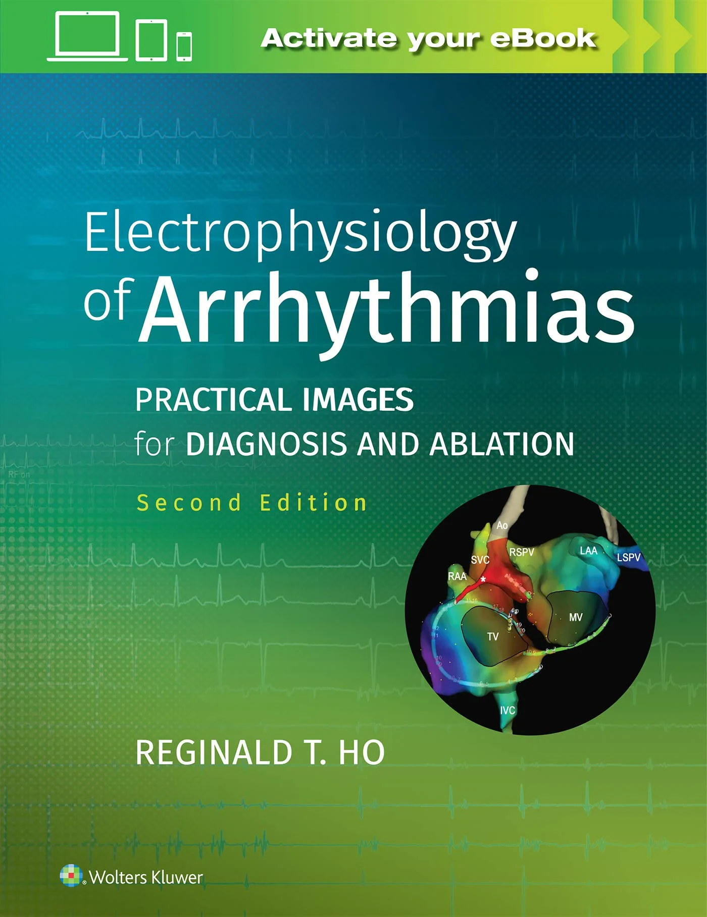 Coperta cărții "Electrophysiology of Arrhythmias: Practical Images for Diagnosis and Ablation" de Reginald T. Ho