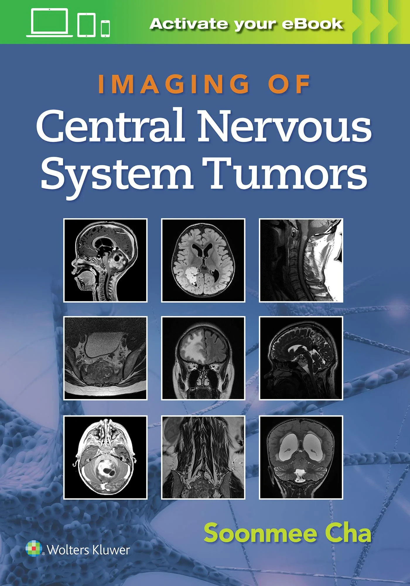 Coperta cărții "Imaging of Central Nervous System Tumors" de Dr. Soonme Cha