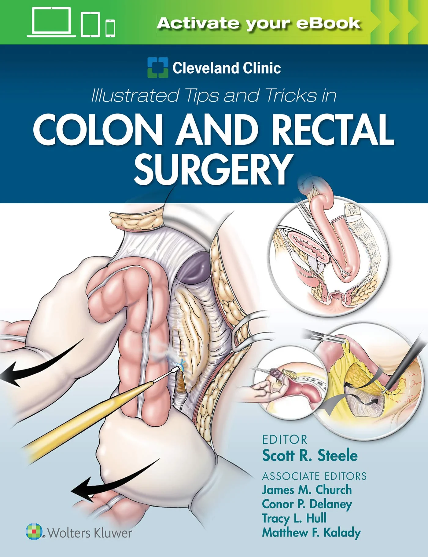 Coperta cărții "Cleveland Clinic Illustrated Tips and Tricks in Colon and Rectal Surgery" de Scott Steele