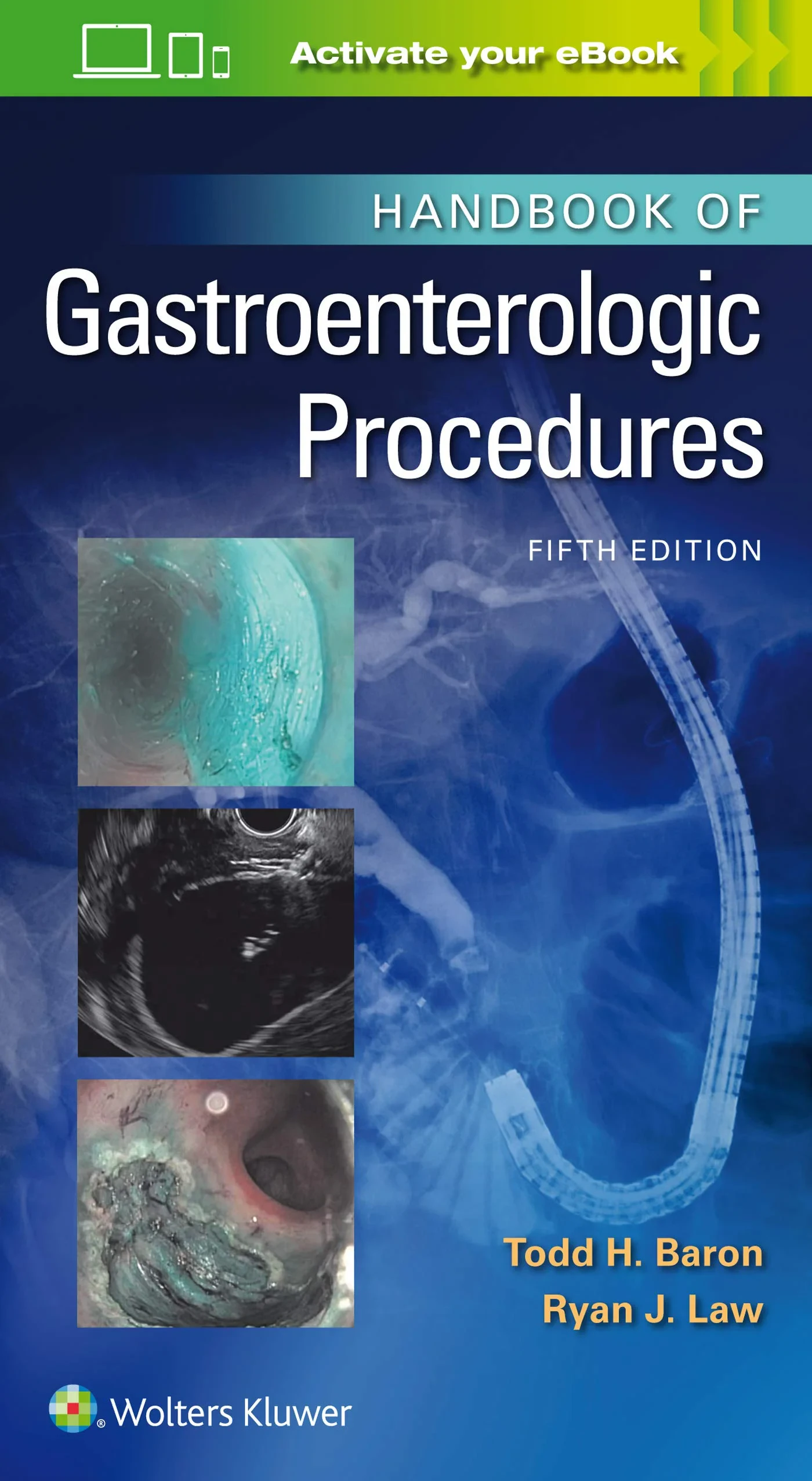 Coperta cărții "Handbook of Gastroenterologic Procedures " de Todd Huntley Baron