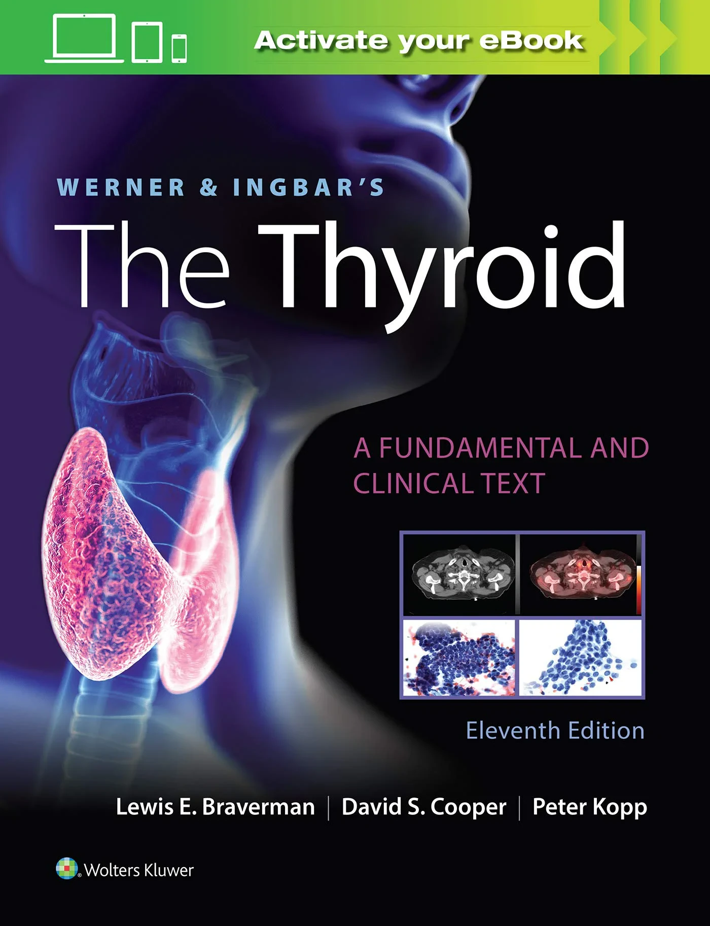 Werner & Ingbar's The Thyroid 