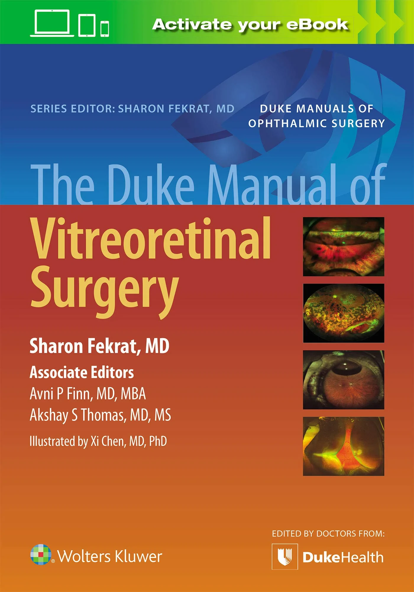Coperta cărții "The Duke Manual of Vitreoretinal Surgery " de Sharon Fekrat