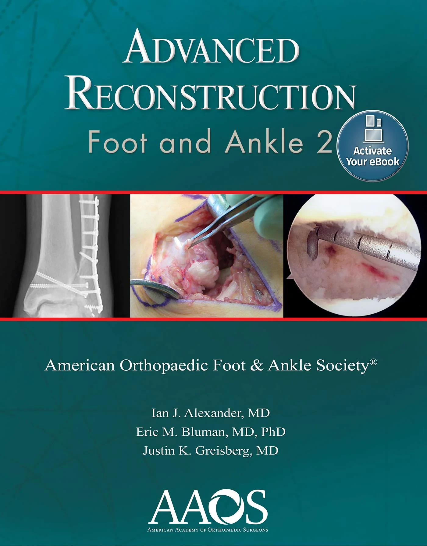 Advanced Reconstruction: Foot and Ankle 2: Print w...
