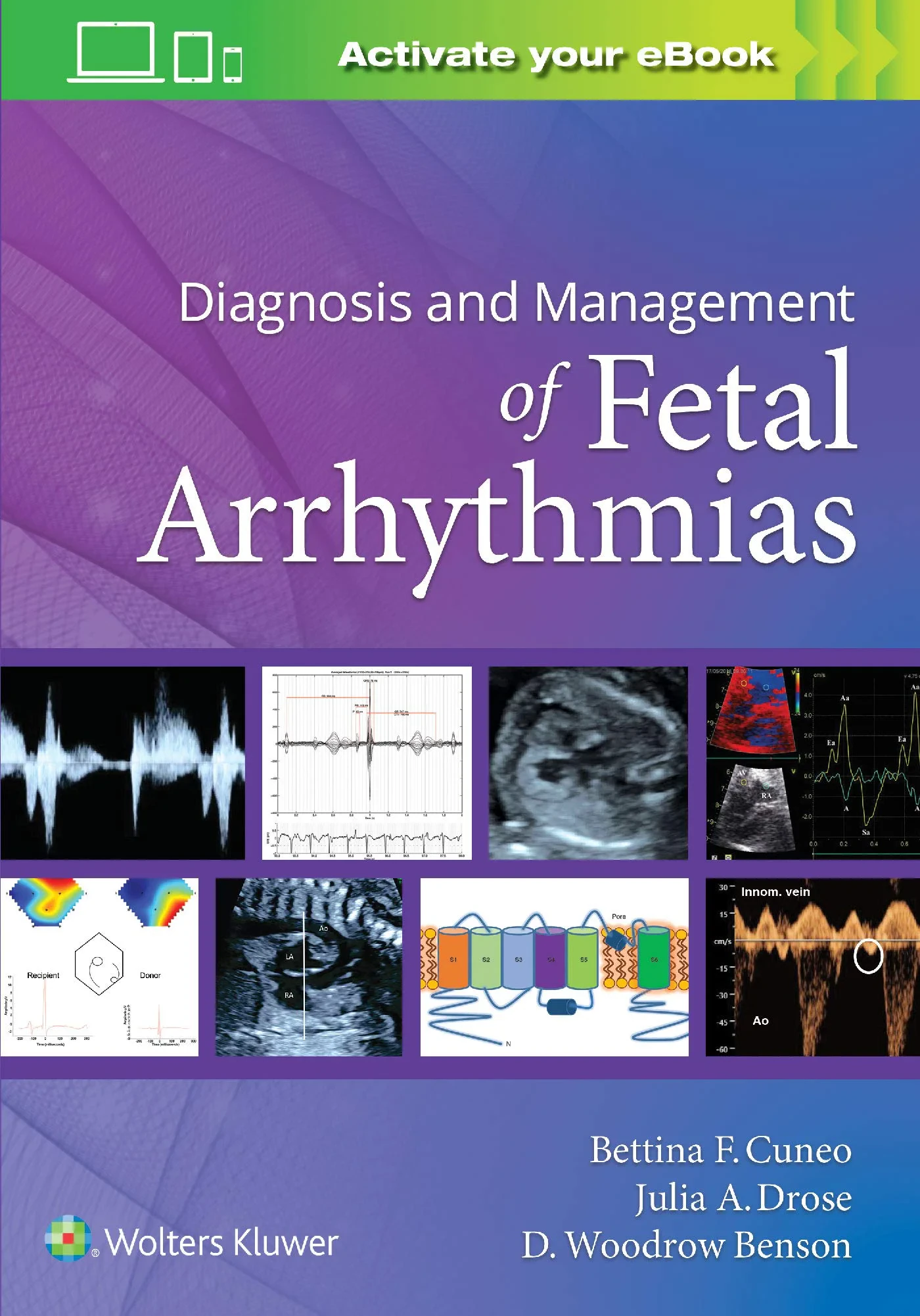 Coperta cărții "Diagnosis and Management of Fetal Arrhythmias " de Bettina Cuneo, Julia Drose, D. Woodrow Benson