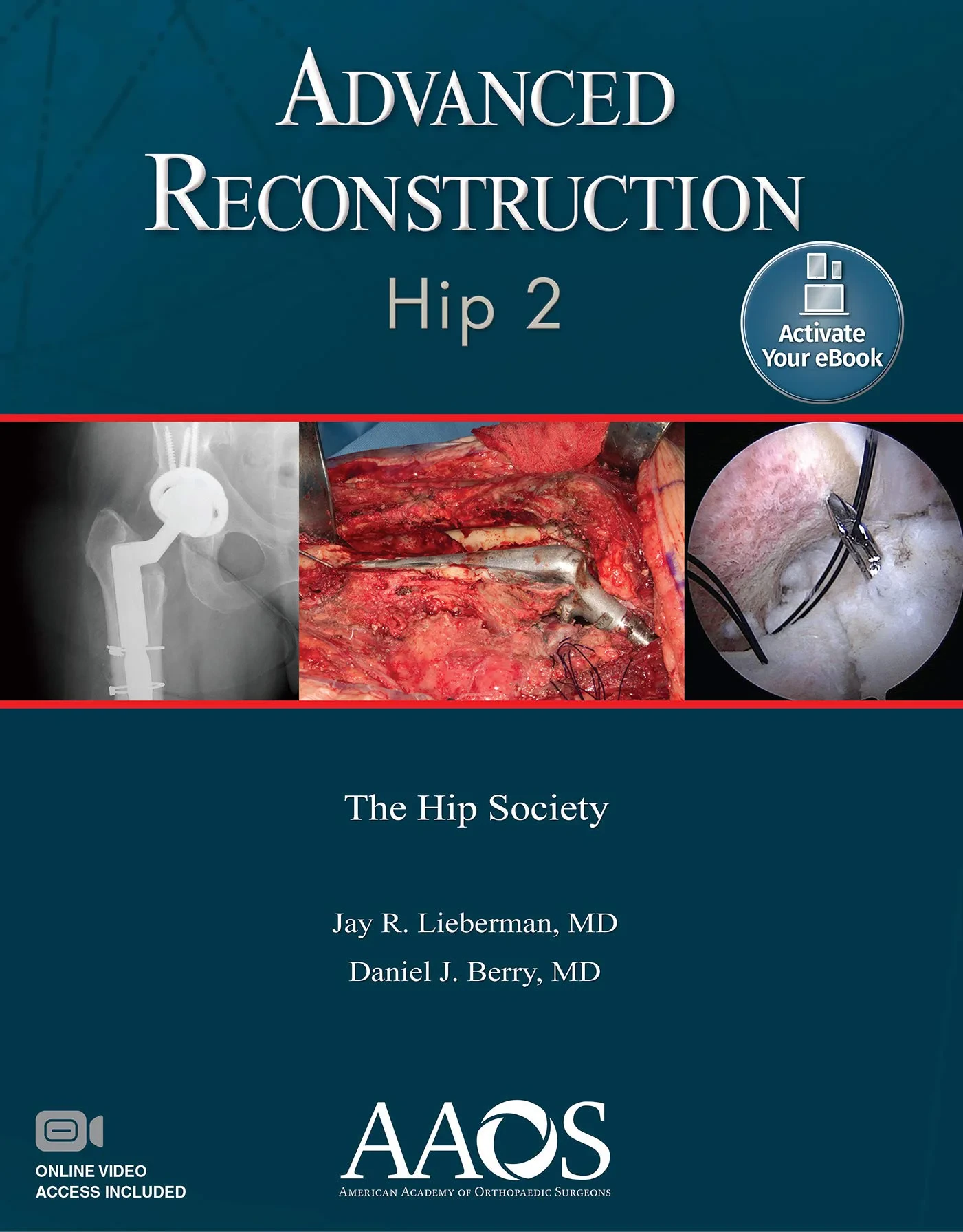 Coperta cărții "Advanced Reconstruction: Hip 2" de Jay R. Lieberman, Daniel J. Berry