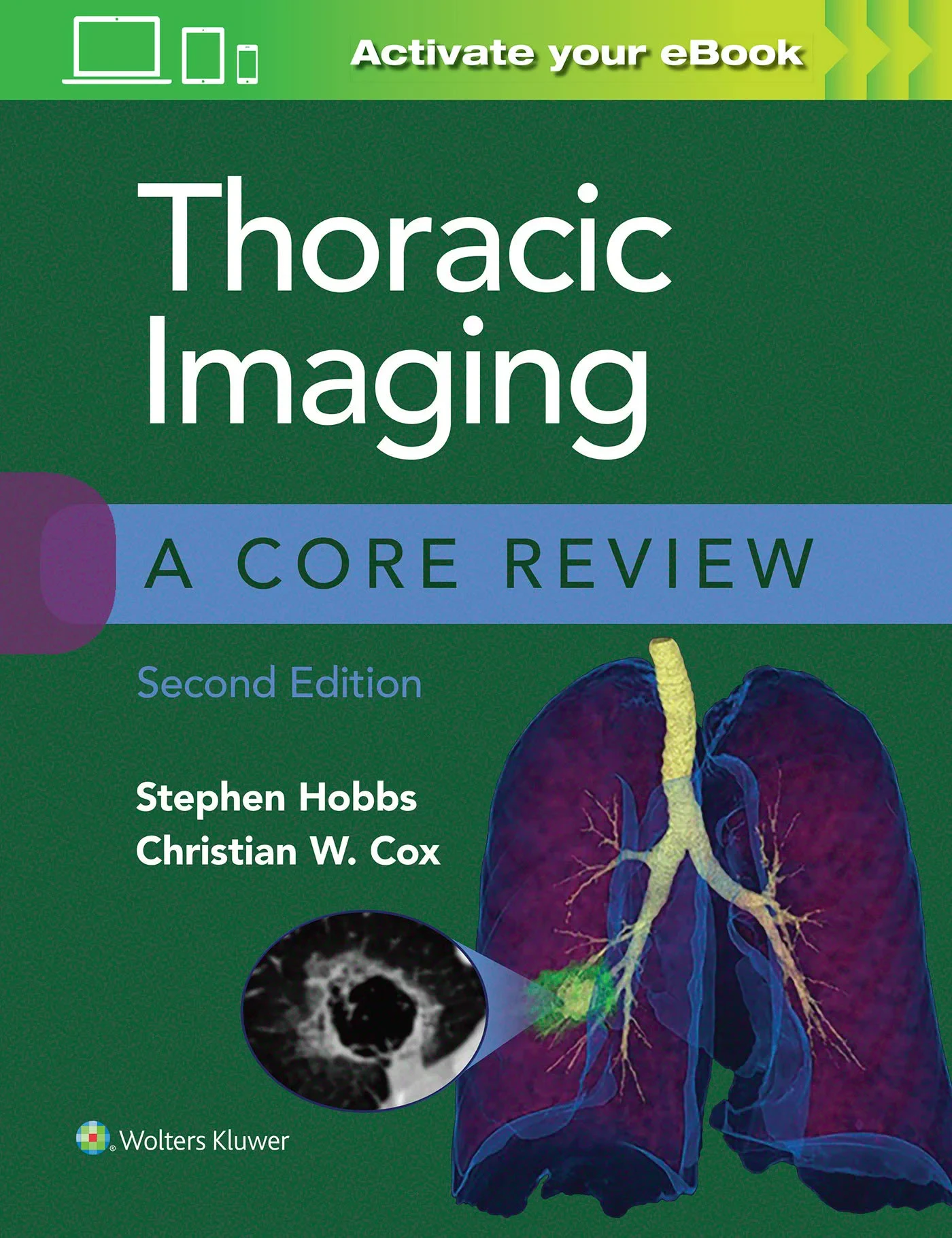 Coperta cărții "Thoracic Imaging: A Core Review" de Stephen Hobbs, Christian Cox