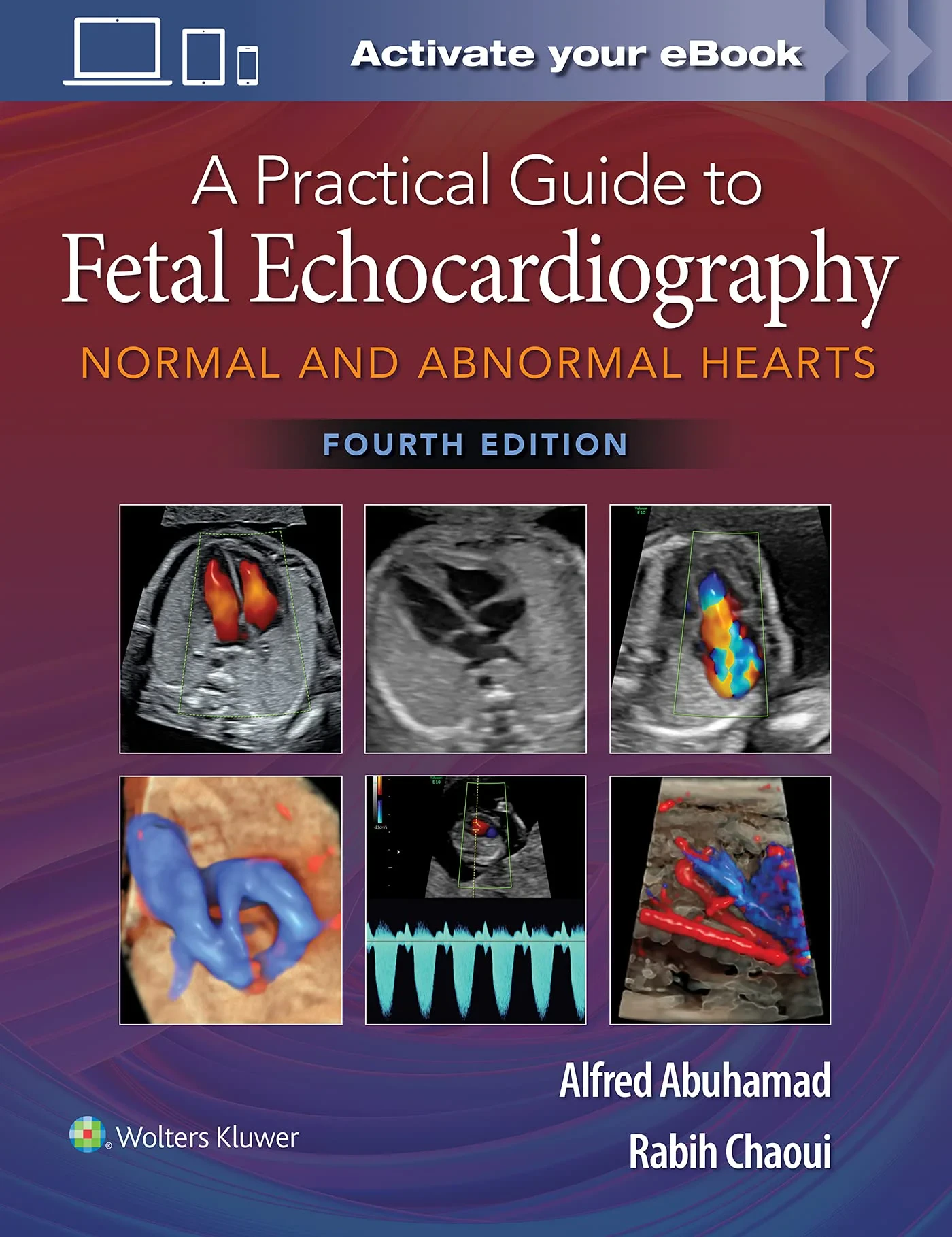 Coperta cărții "A Practical Guide to Fetal Echocardiography: Normal and Abnormal Hearts" de Alfred Z. Abuhamad, Rabih Chaoui