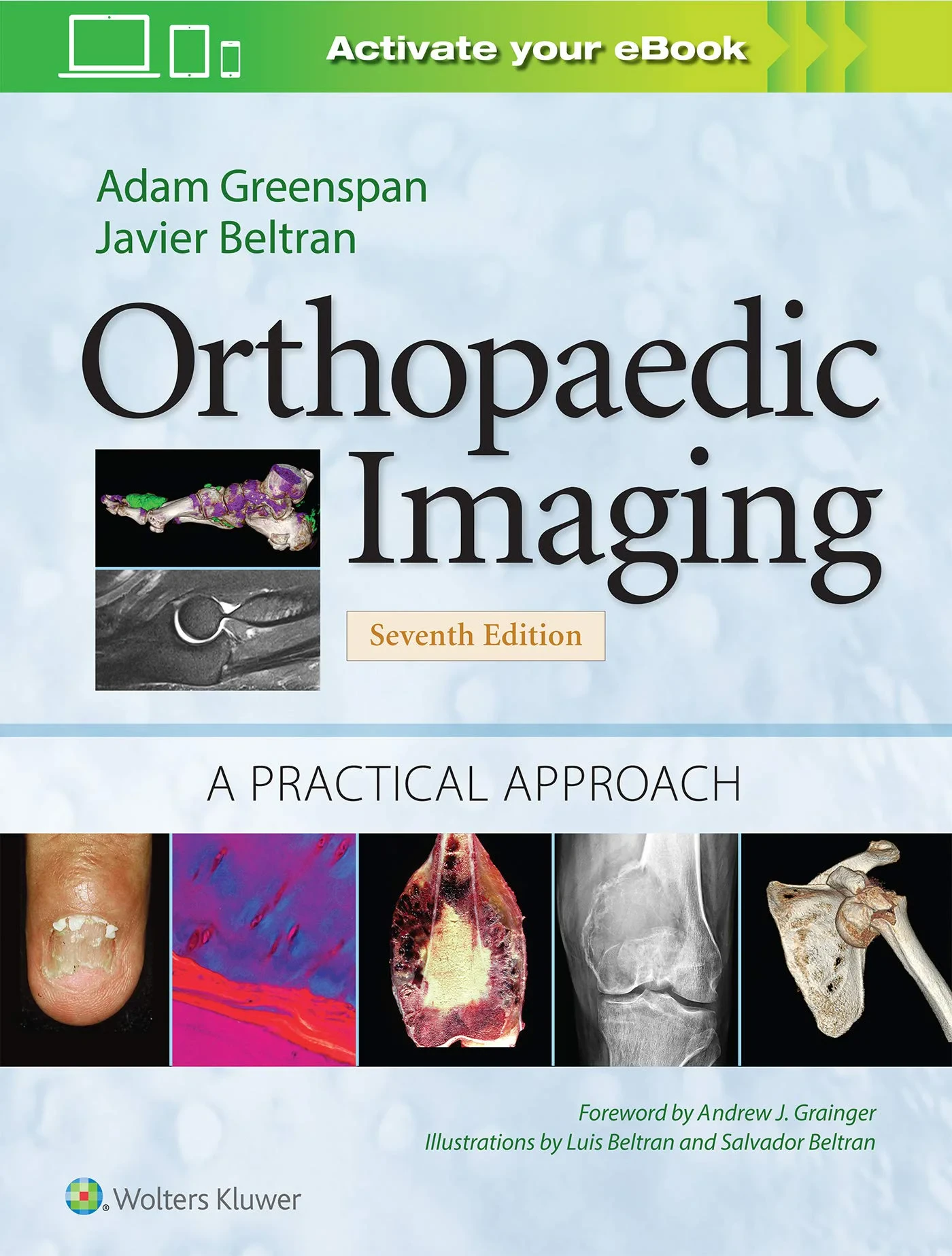 Orthopaedic Imaging: A Practical Approach (Orthope...