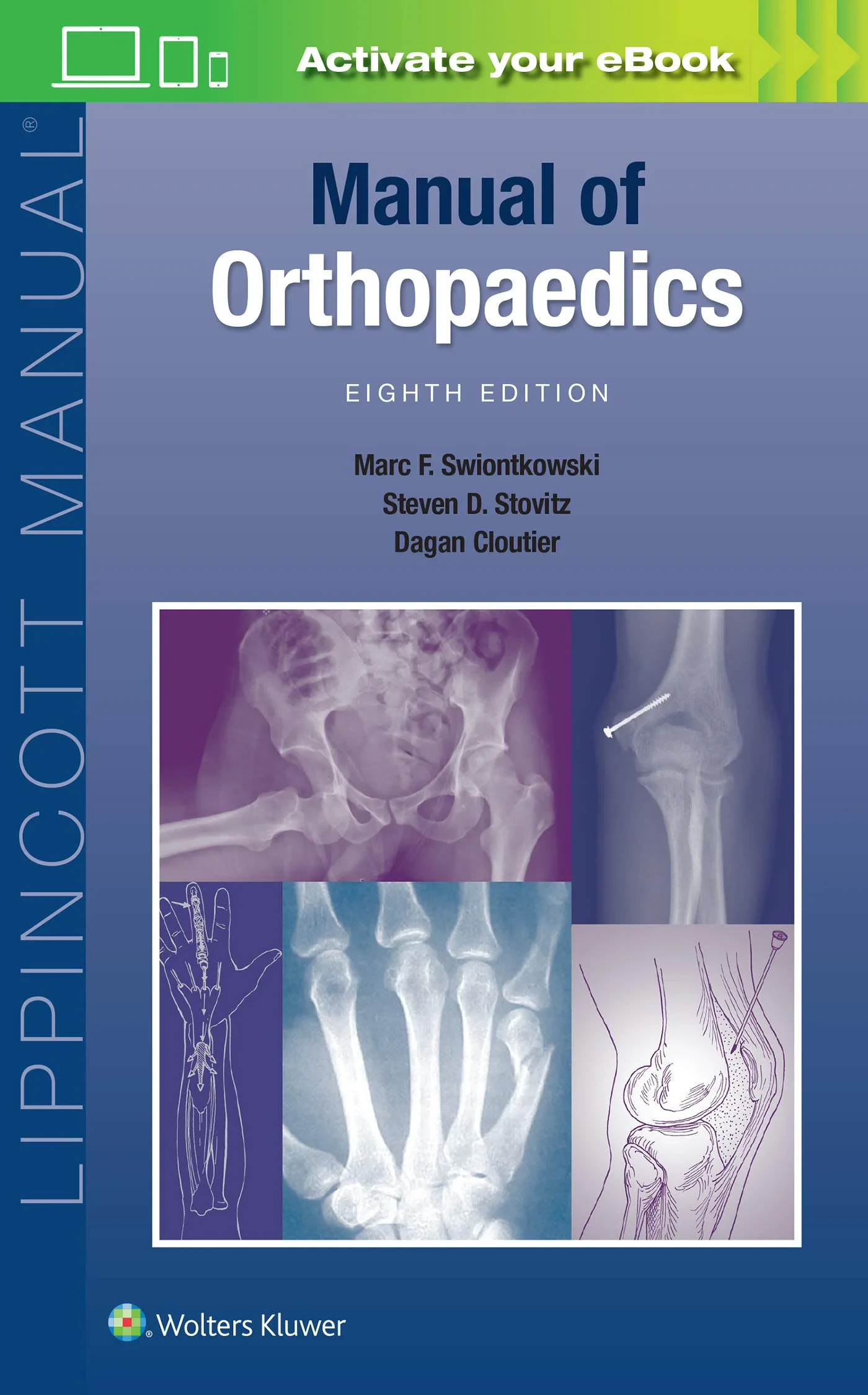 Coperta cărții "Manual of Orthopaedics " de Marc F. Swiontkowski M.D