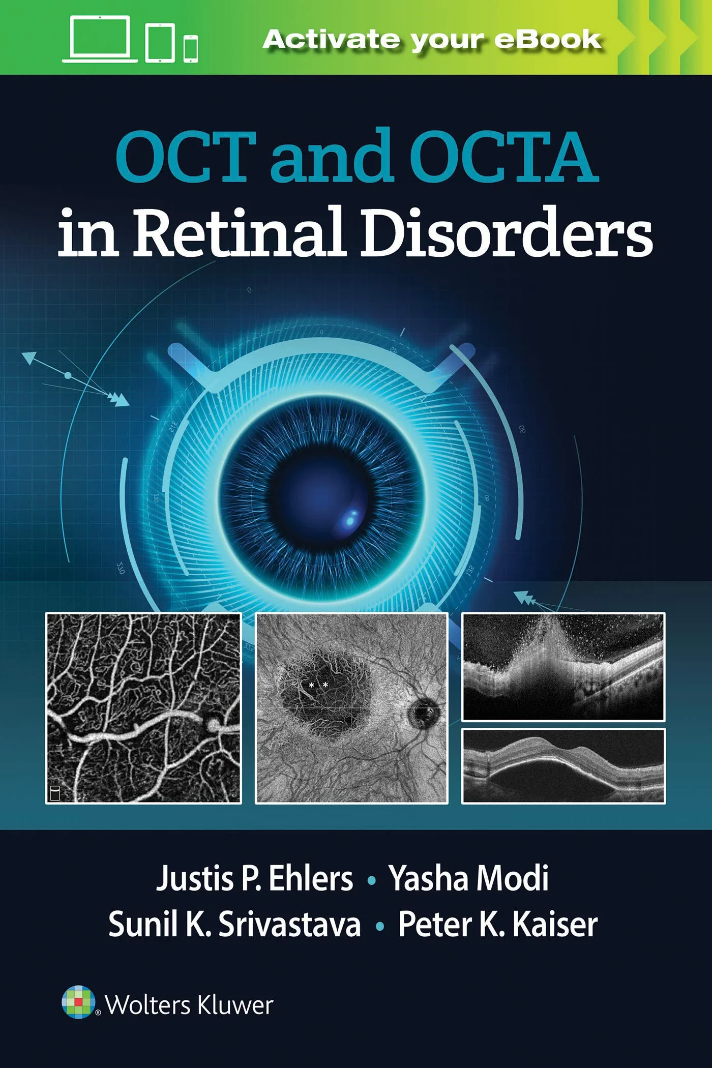 Coperta cărții "OCT and OCTA Angiography in Retinal Disorders" de Justis P. Ehlers