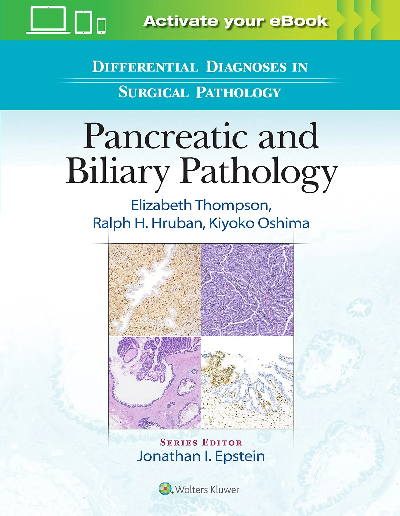 Differential Diagnoses in Surgical Pathology: Panc...