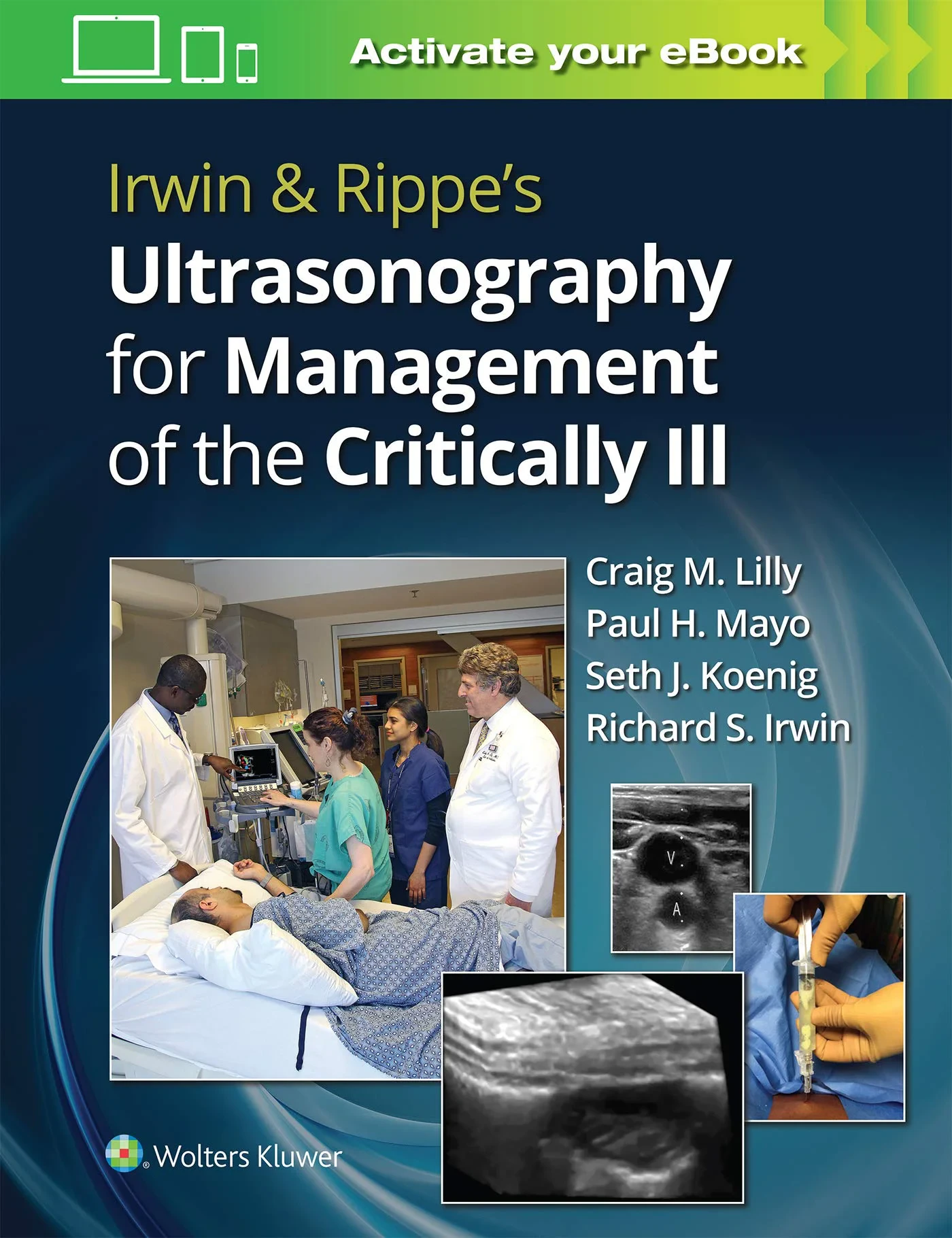 Coperta cărții "Irwin &amp; Rippe’s Ultrasonography for Management of the Critically Ill" de Craig M. Lilly MD, Paul H. Mayo, Seth J. Koenig, Richard S. Irwin MD
