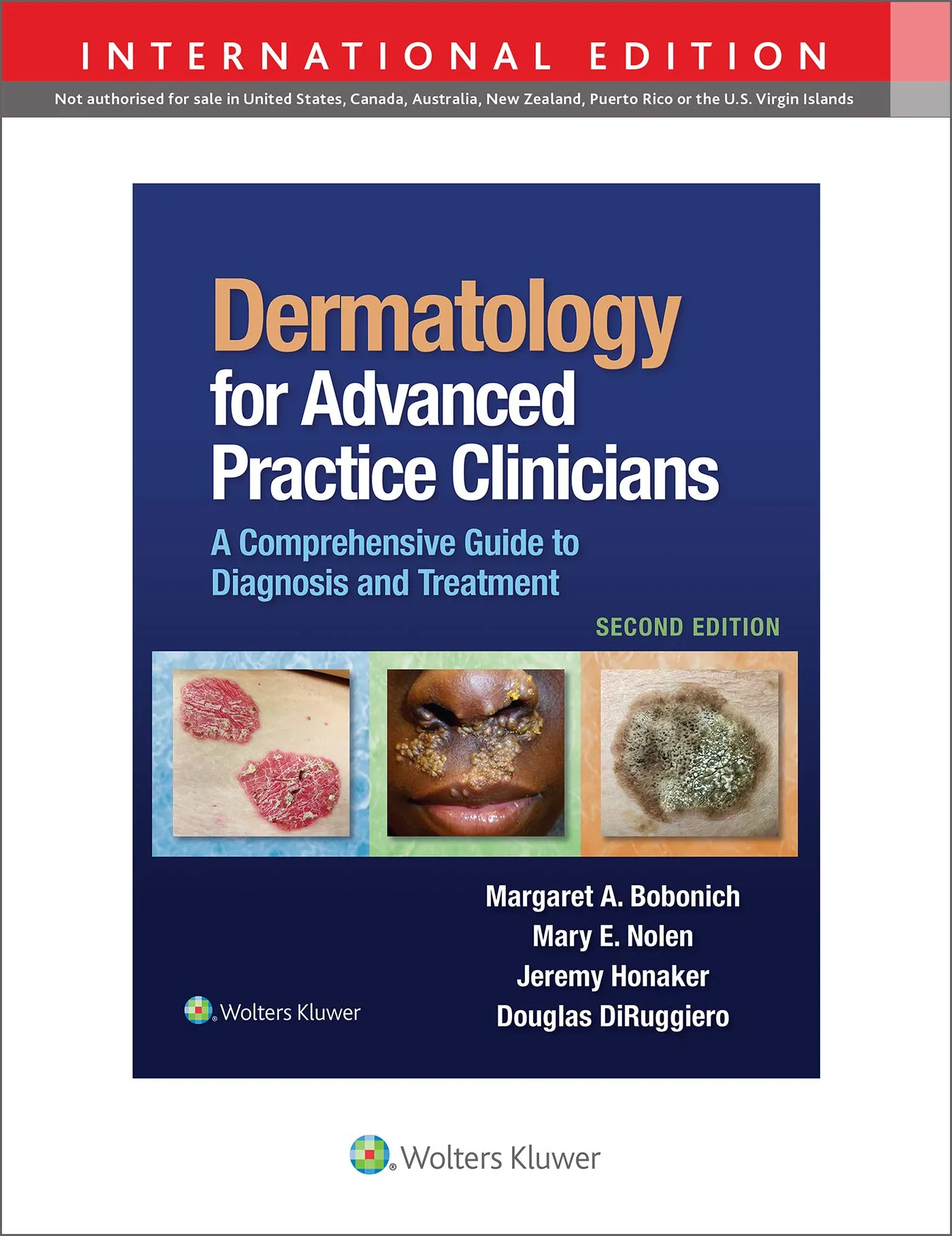 Coperta cărții "Dermatology for Advanced Practice Clinicians: A Practical Approach to Diagnosis and Management" de Margaret Bobonich