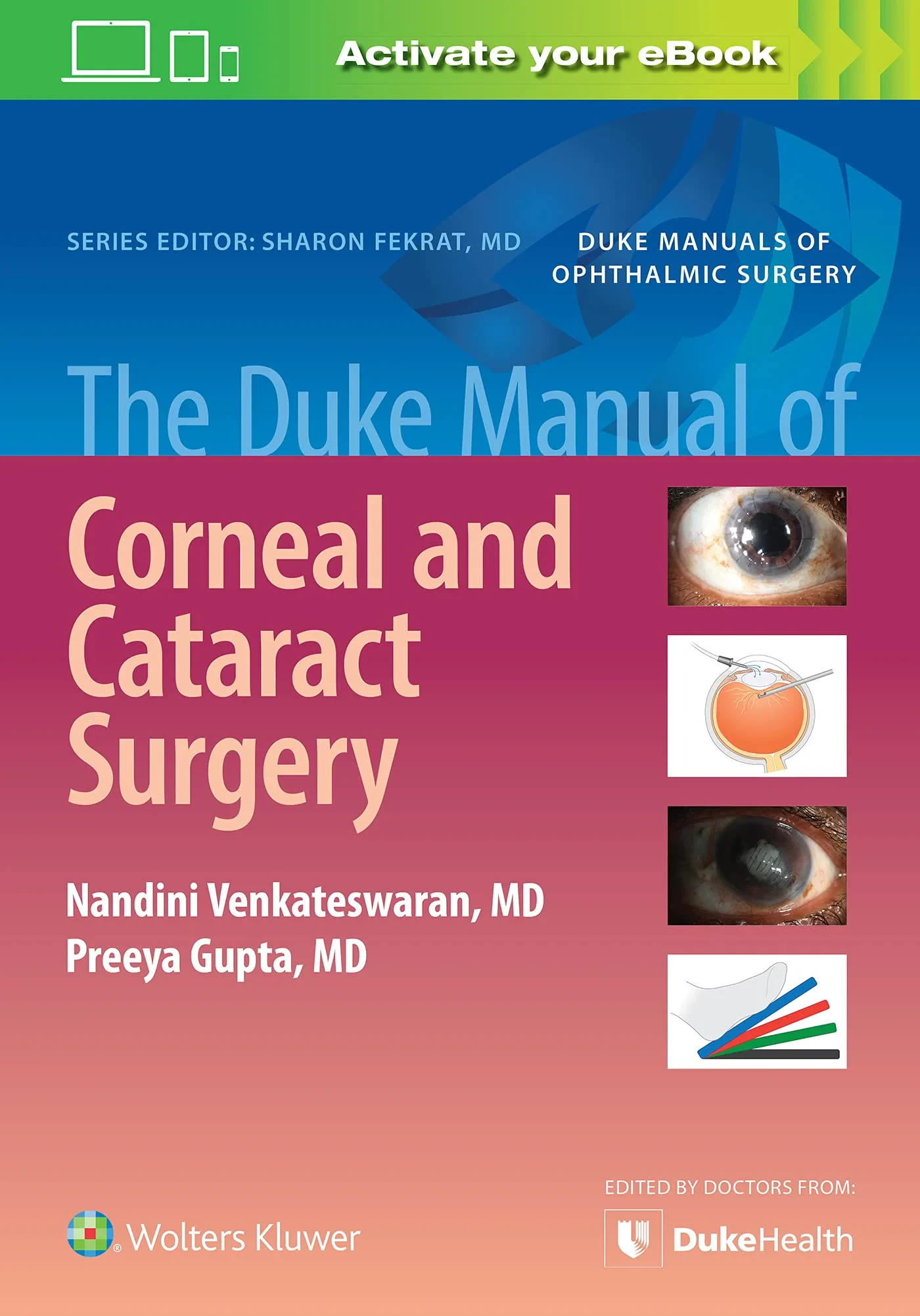 Coperta cărții "The Duke Manual of Corneal and Cataract Surgery" de Preeya Gupta, Nandini Venkateswaran