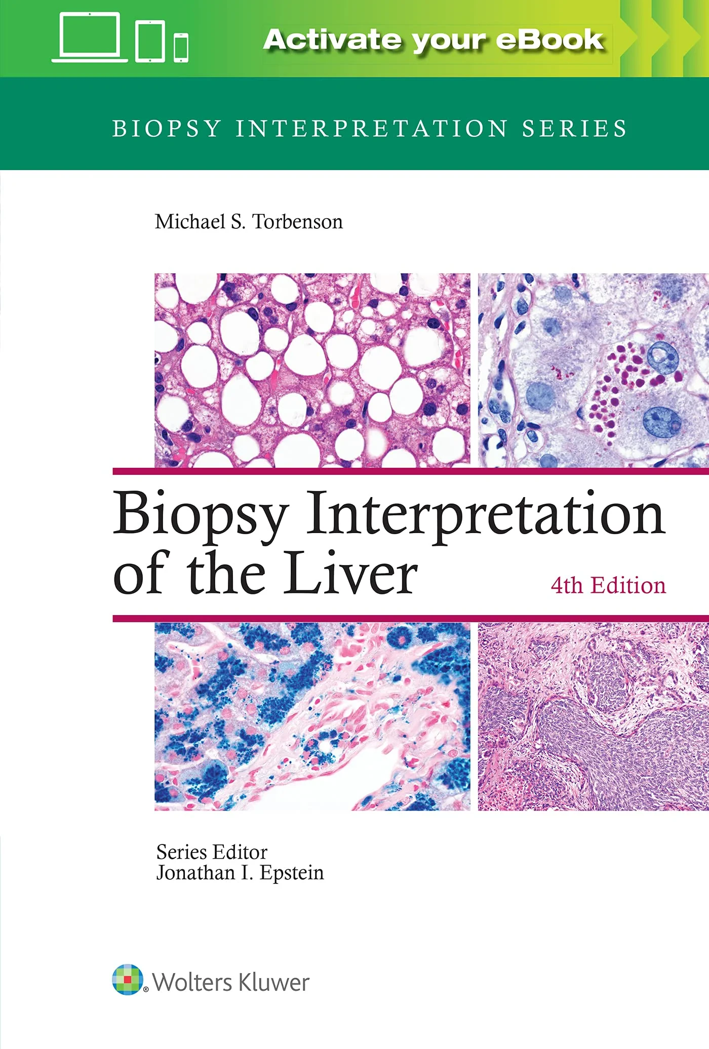 Coperta cărții "Biopsy Interpretation of the Liver 4th edition" de Michael Torbenson MD