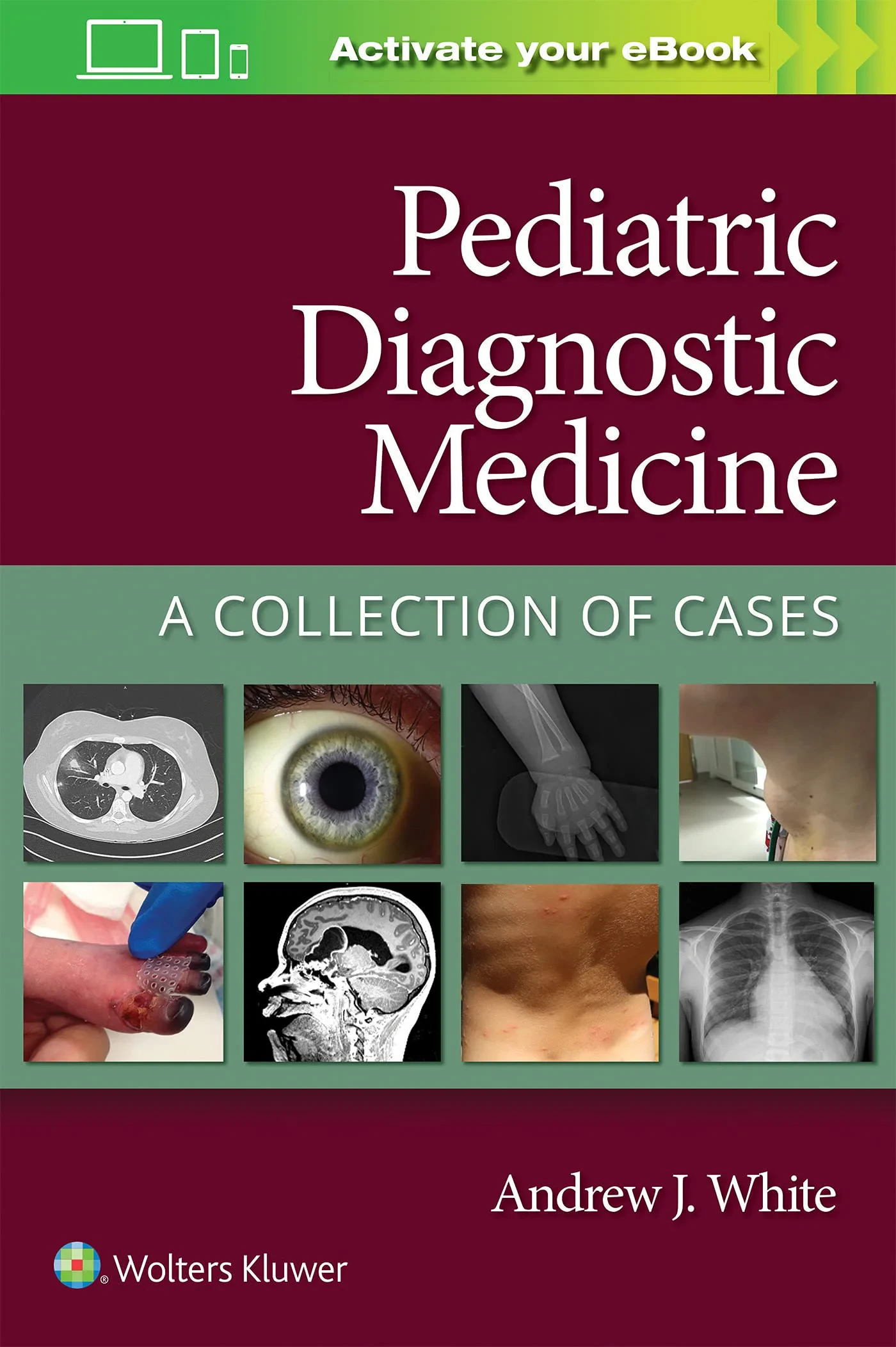 Coperta cărții "Pediatric Diagnostic Medicine: A Collection of Cases " de Andrew White MD