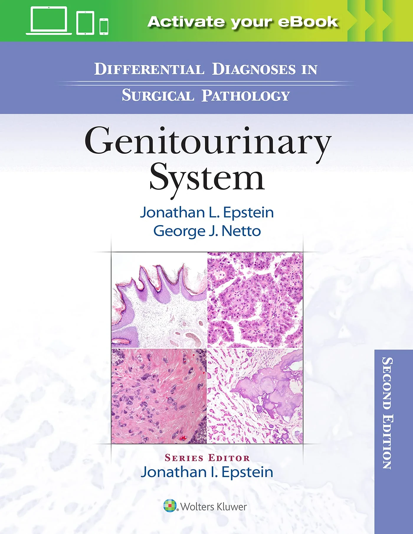 Coperta cărții "Differential Diagnoses in Surgical Pathology: Genitourinary System" de Jonathan Epstein, George J. Netto