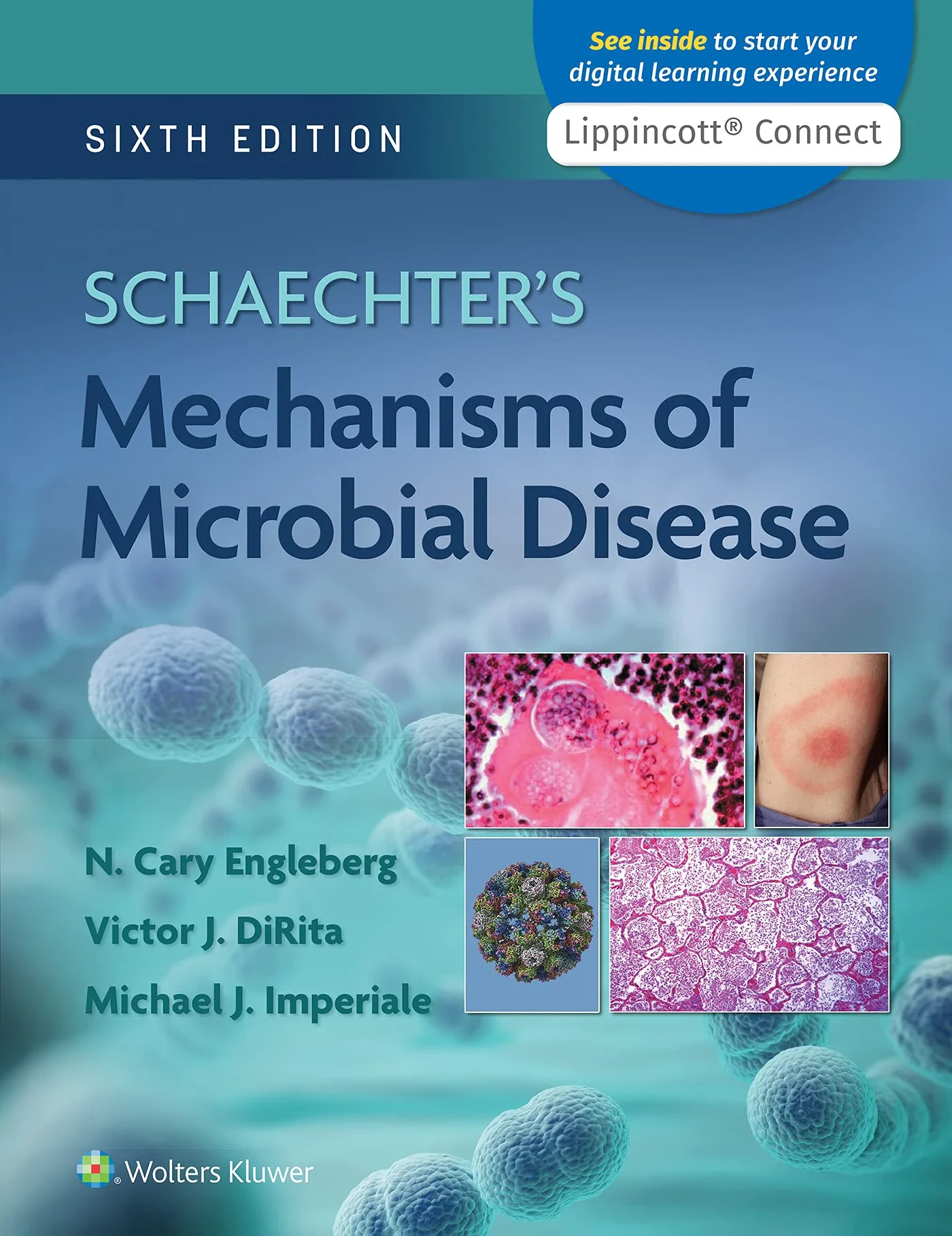 Coperta cărții "Schaechter’s Mechanisms of Microbial Disease" de N. Cary Engleberg MD, Michael Imperiale Ph.D, Victor DiRita PhD