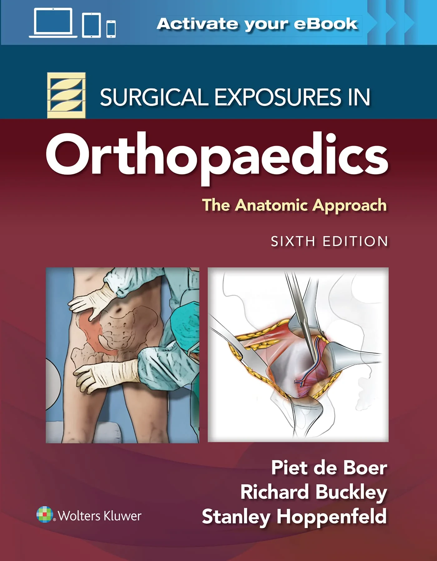 Surgical Exposures in Orthopaedics: The Anatomic A...