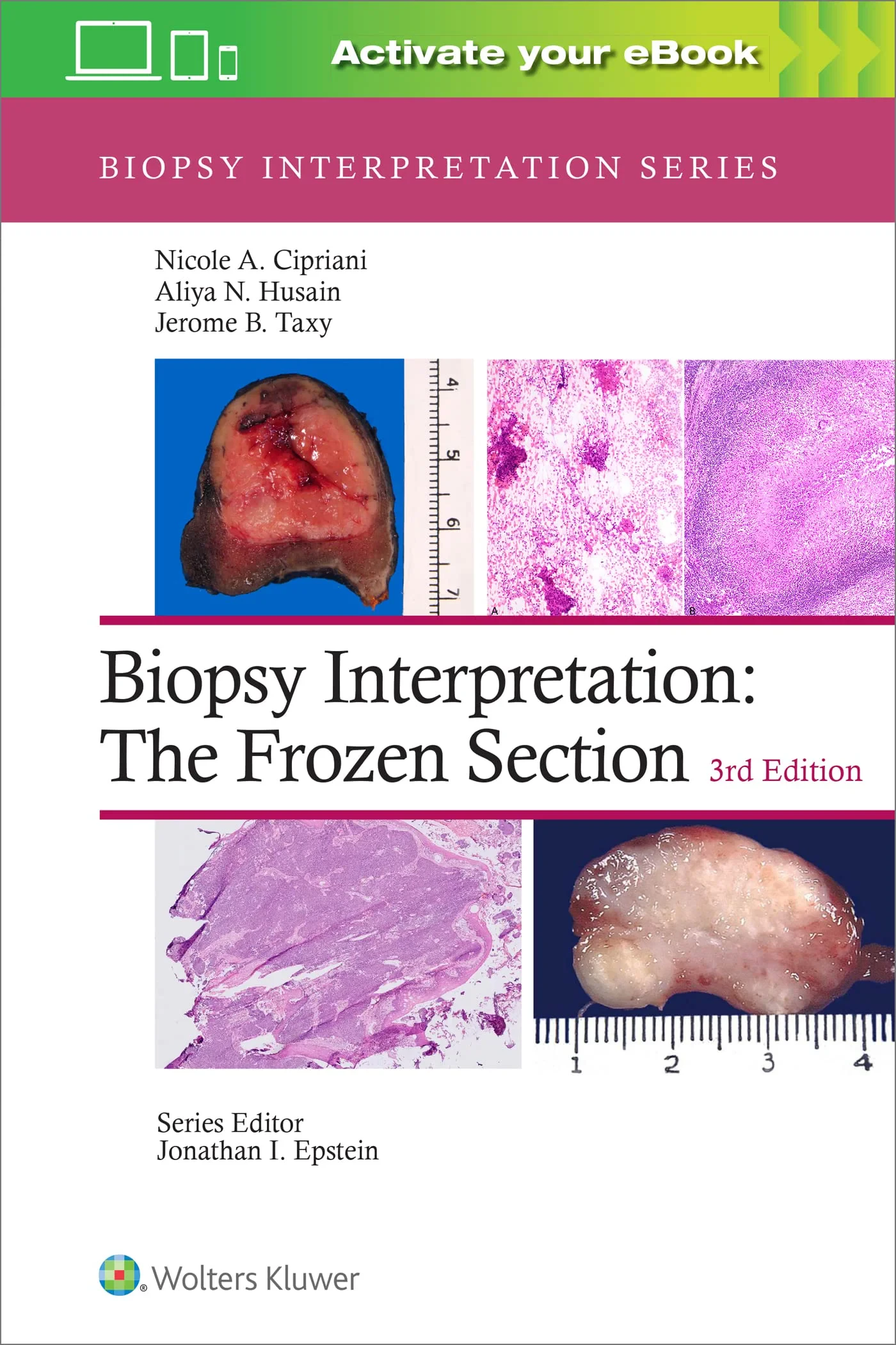 Coperta cărții "Biopsy Interpretation: The Frozen Section" de Aliya N. Husain MD, Nicole A. Cipriani MD, Jerome B. Taxy MD