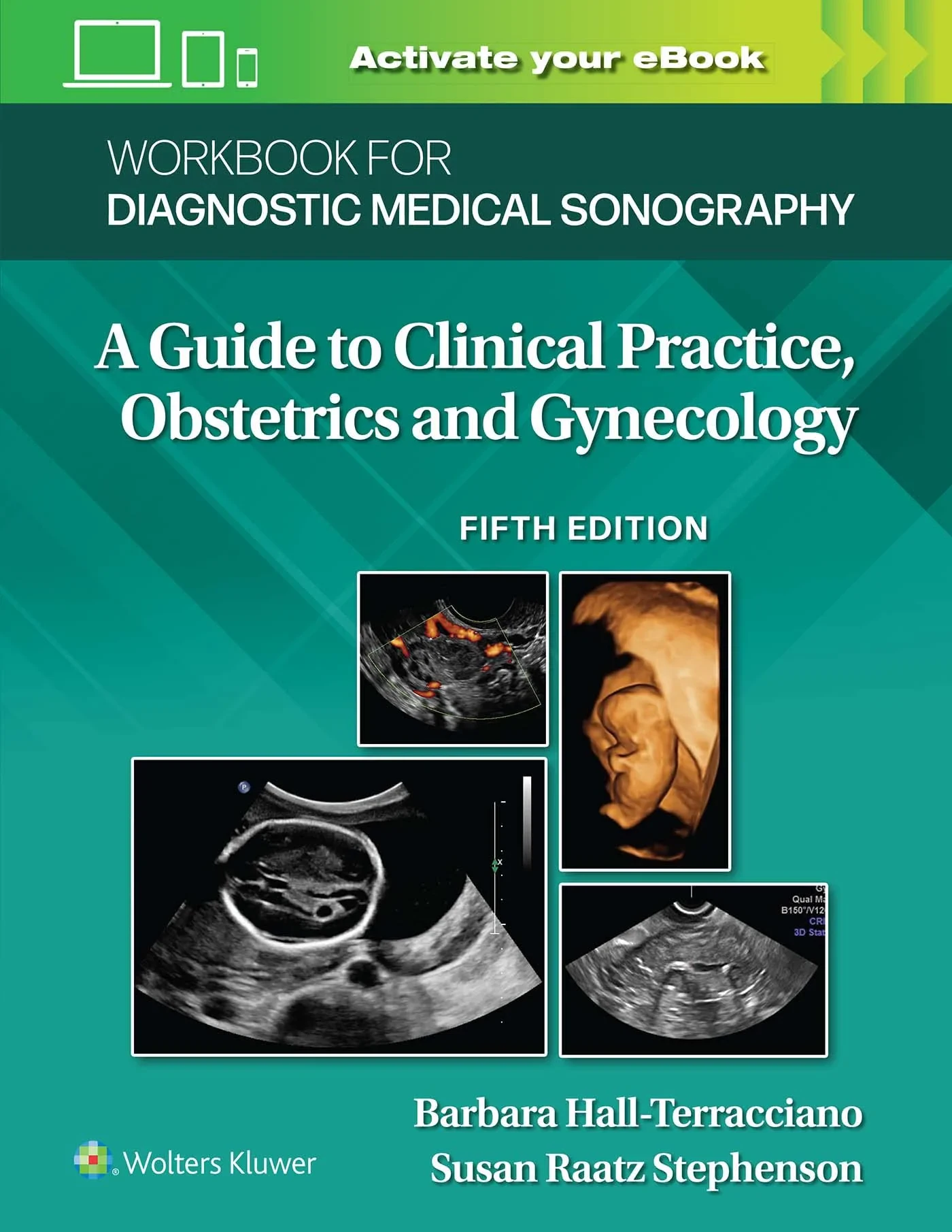Coperta cărții "Workbook for Diagnostic Medical Sonography" de Susan Stephenson