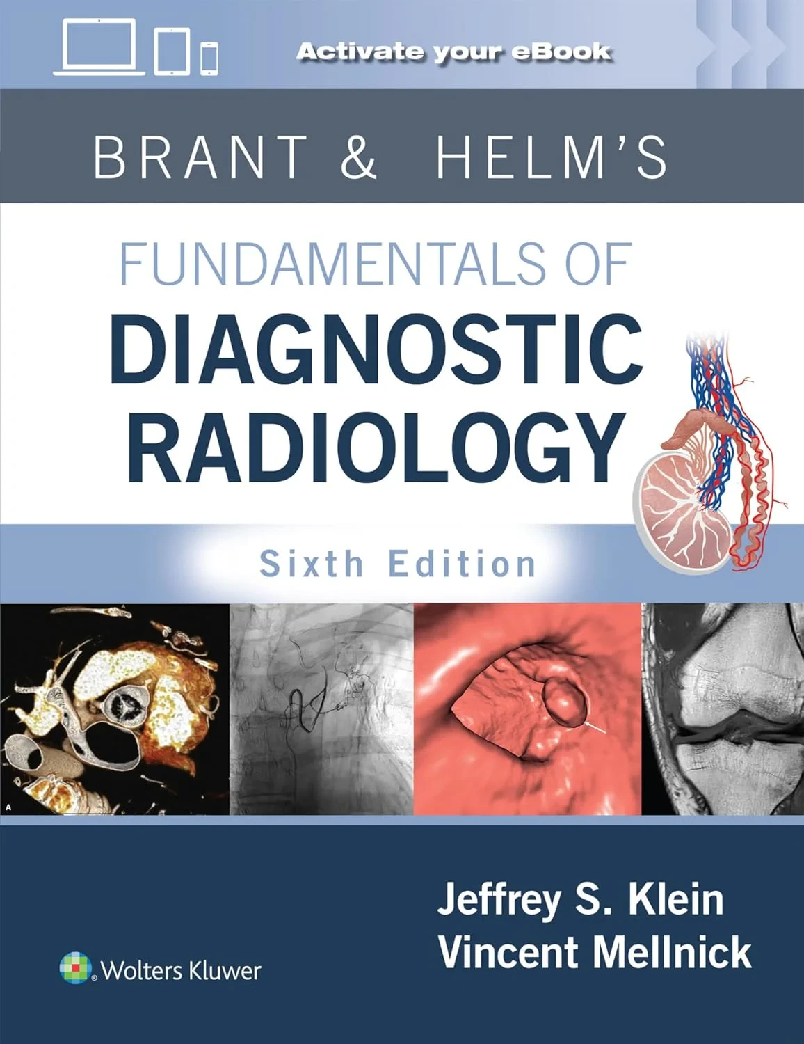 Brant & Helm’s Fundamentals of Diagnostic Radiolog...