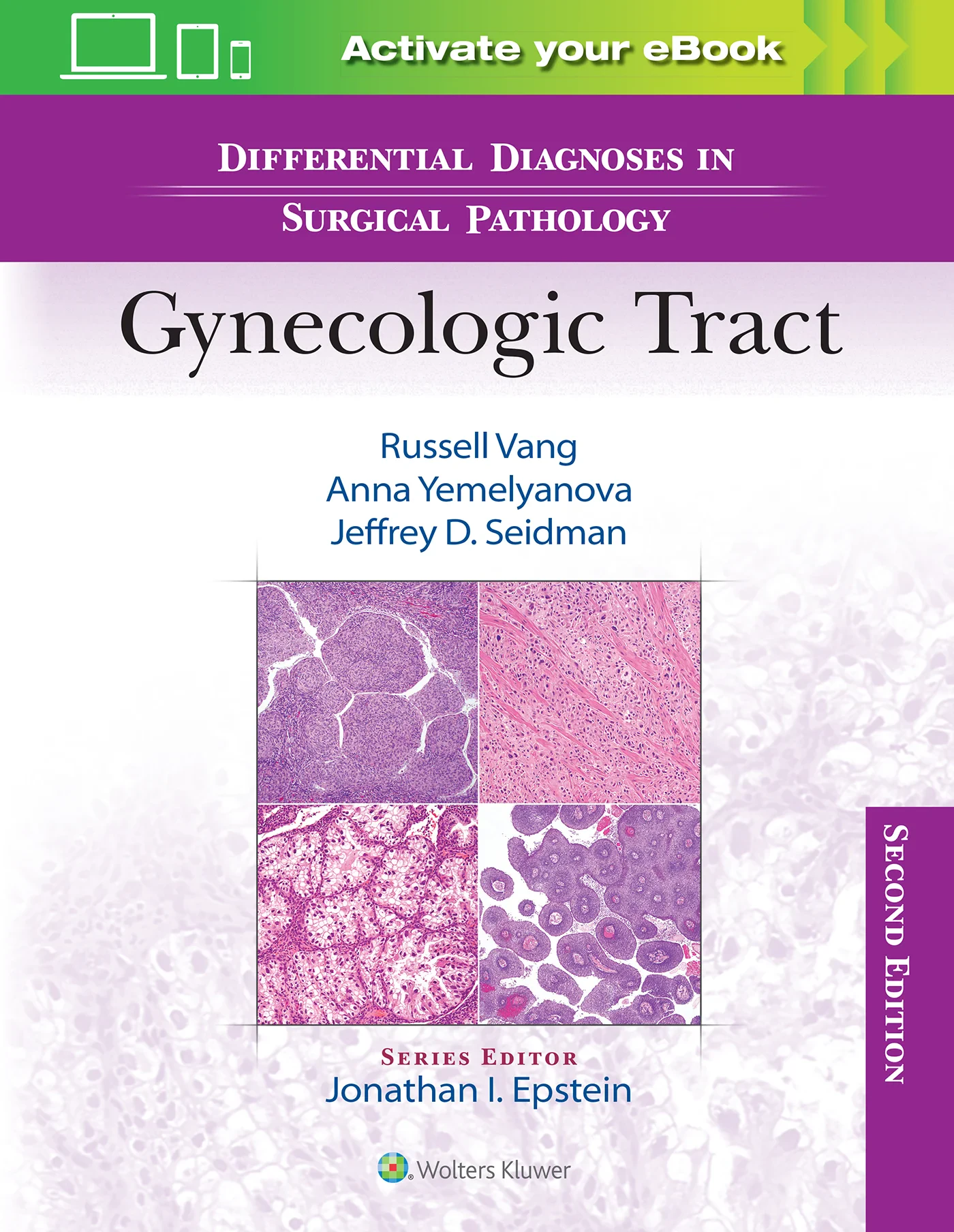 Differential Diagnoses in Surgical Pathology: Gyne...