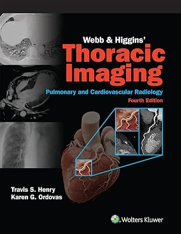Webb & Higgins Thoracic Imaging:  Print + Digital ...