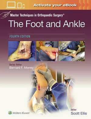 Master Techniques in Orthopaedic Surgery: The Foot...