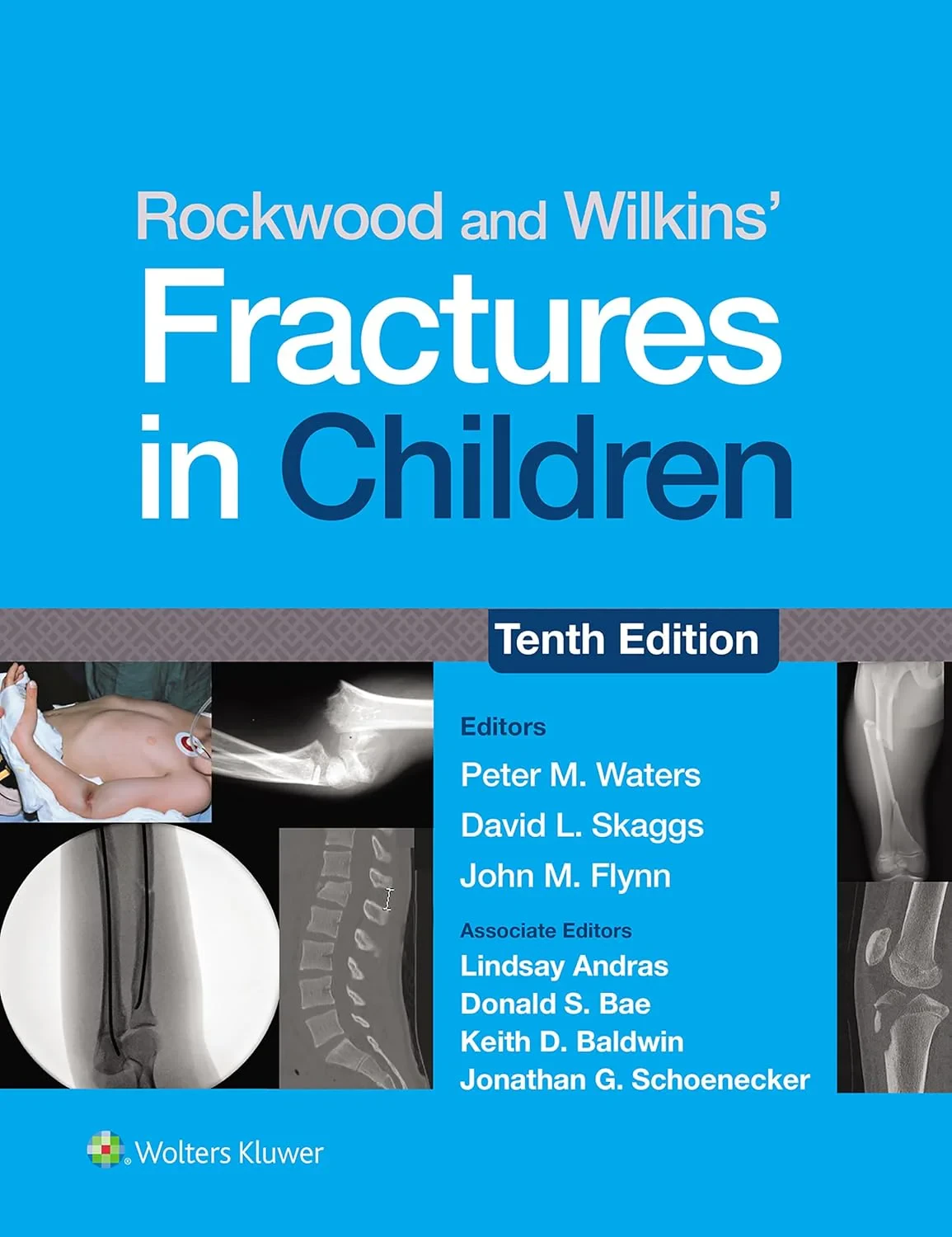 Rockwood and Wilkins’ Fractures in Children, Tenth...