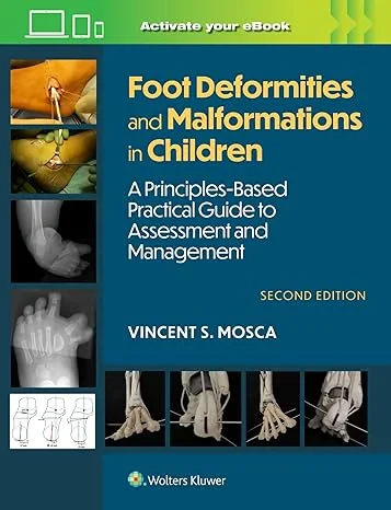 Foot Deformities and Malformations in Children: A ...