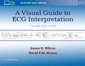 Coperta cărții "A Visual Guide to ECG Interpretation" de Susan Renee Wilcox, DAVID F. M. BROWN