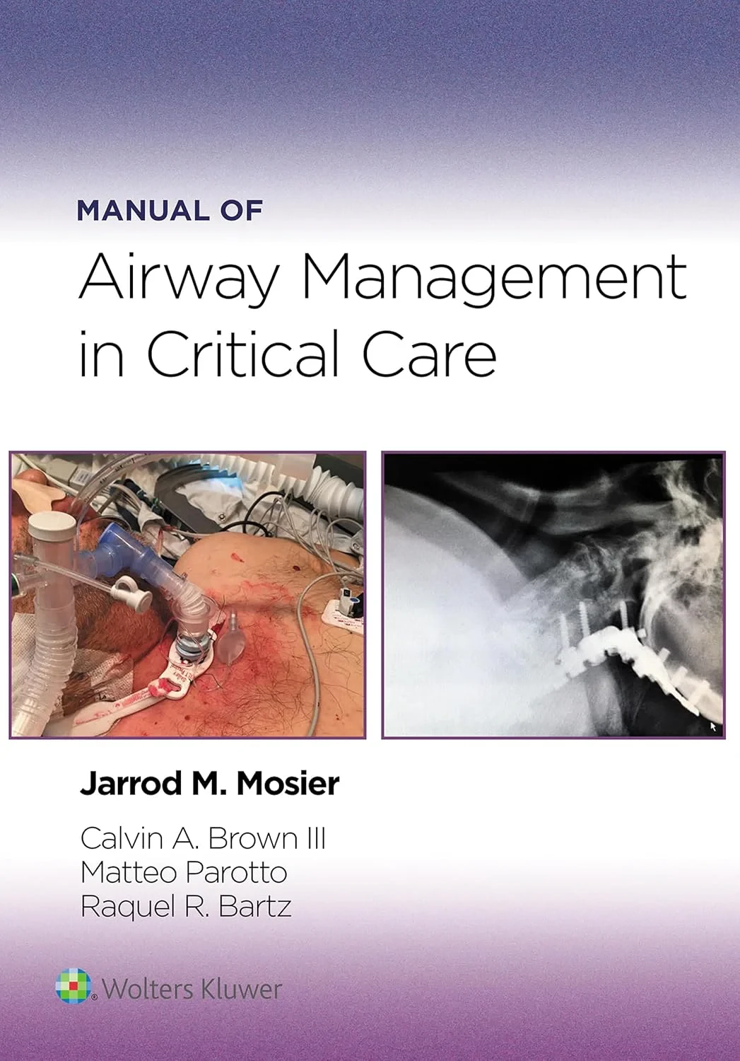 Coperta cărții "Manual of Airway Management in Critical Care" de III MD, Jarrod Mosier MD, PLLC, Calvin A Brown, Matteo Parotto M.D., Ph.D, Raquel Rae Bartz