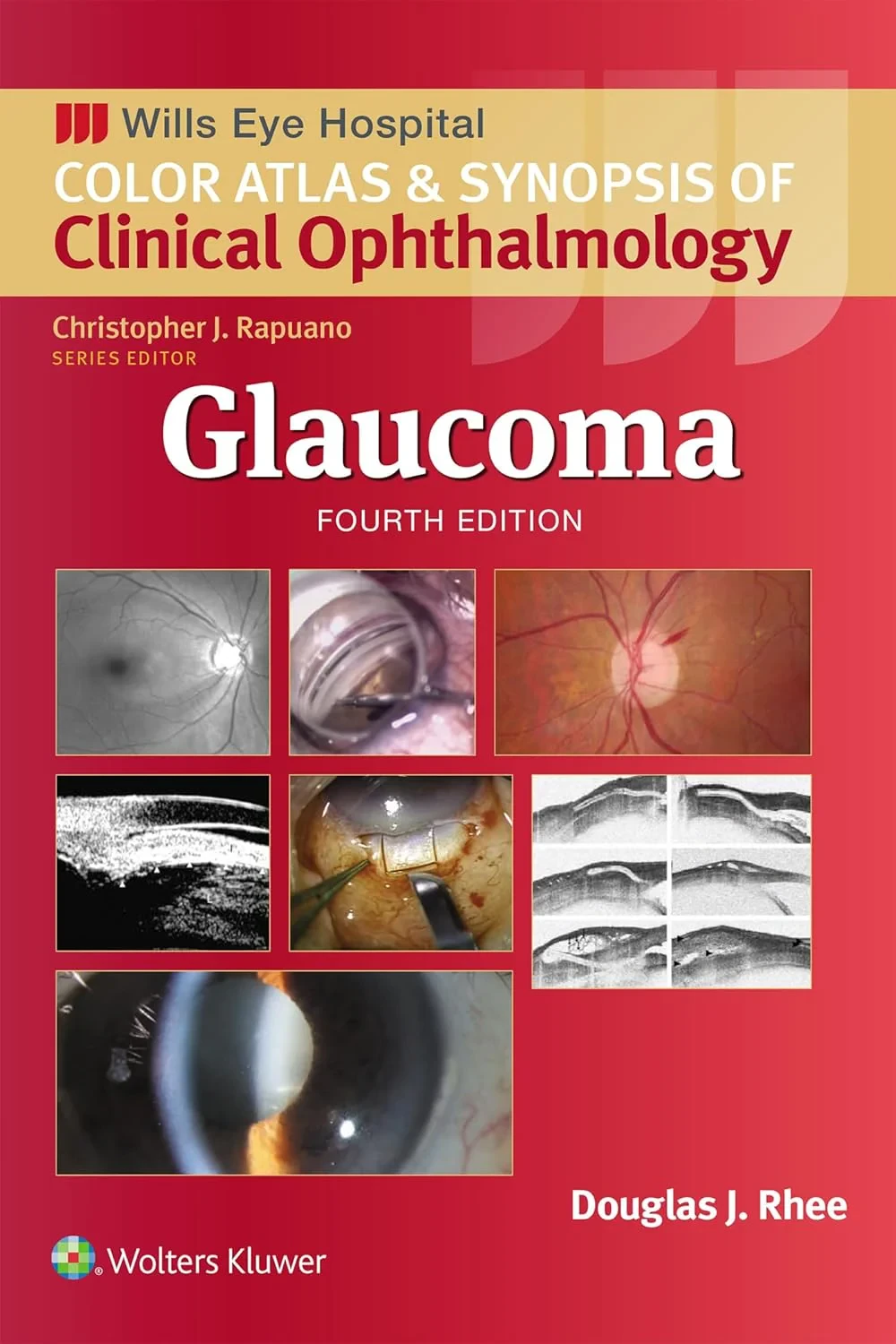 Coperta cărții "Glaucoma (Wills Eye Institute Atlas Series)" de Douglas J. Rhee