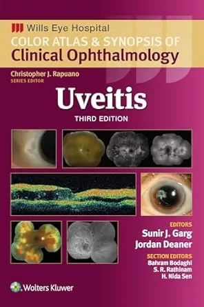 Coperta cărții "Uveitis. Third edition" de MD, Sunir J. Garg