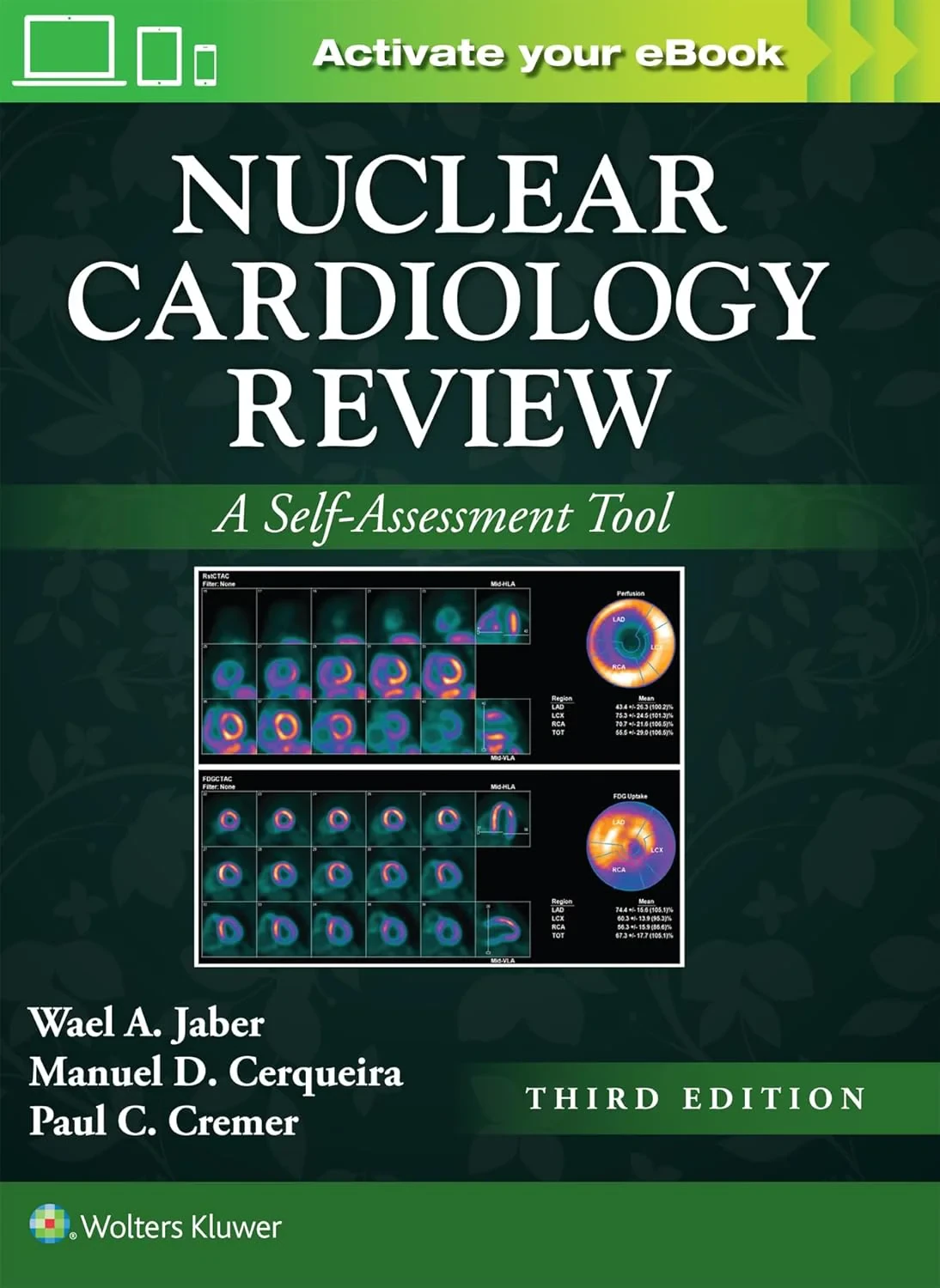 Coperta cărții "Nuclear Cardiology Review" de WAEL A. JABER, MANUEL CERQUEIRA, Paul Cremer M.D.