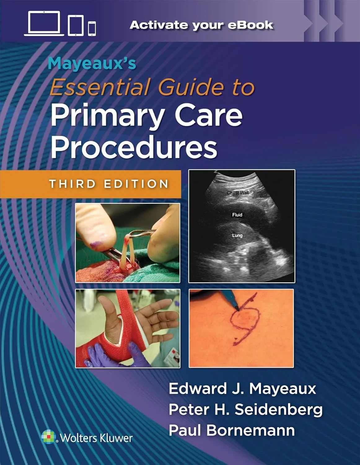 Mayeaux's Essential Guide to Primary Care Procedur...