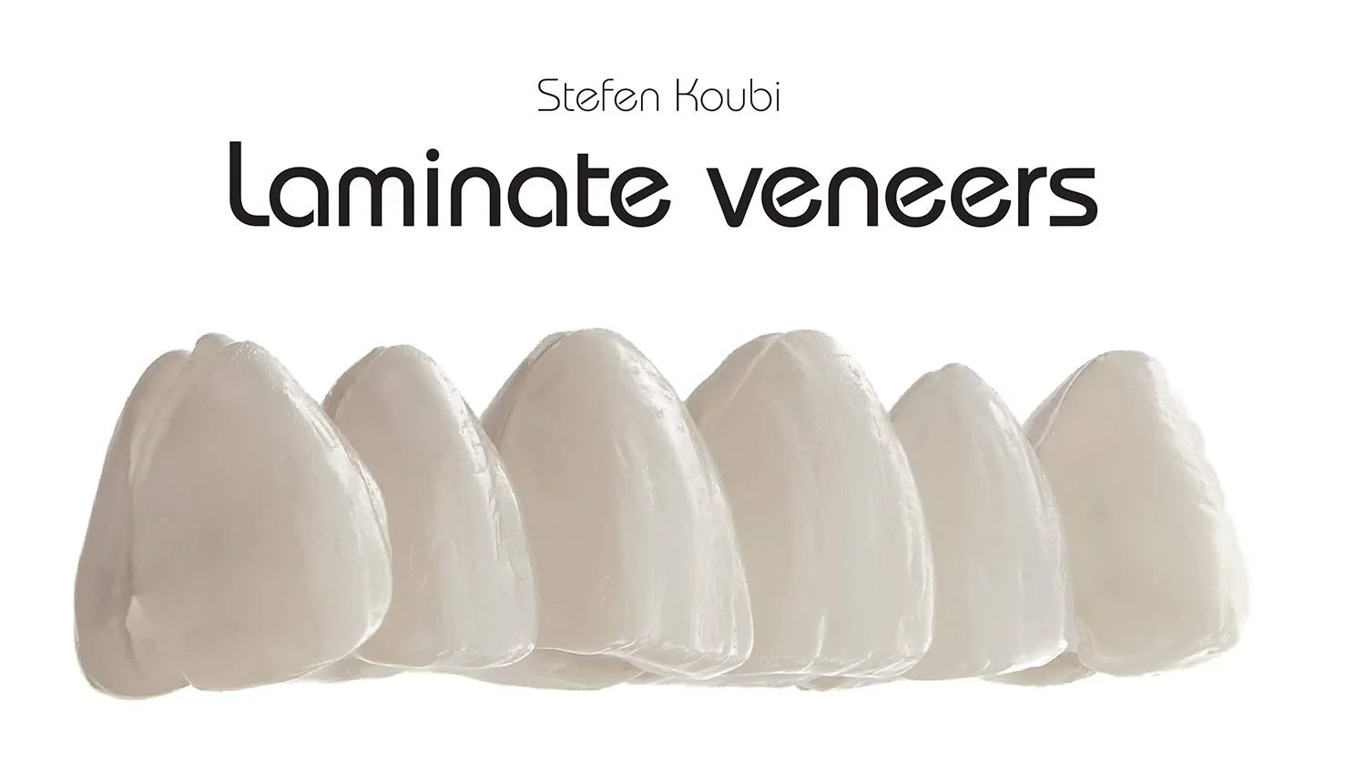Laminate Veneers: 20 Recipes for Smile Design