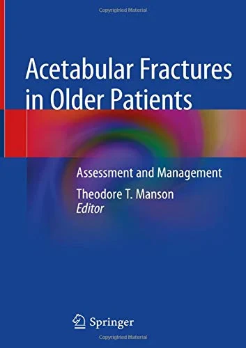 Coperta cărții "Acetabular Fractures in Older Patients: Assessment and Management" de Manson, Theodore T.