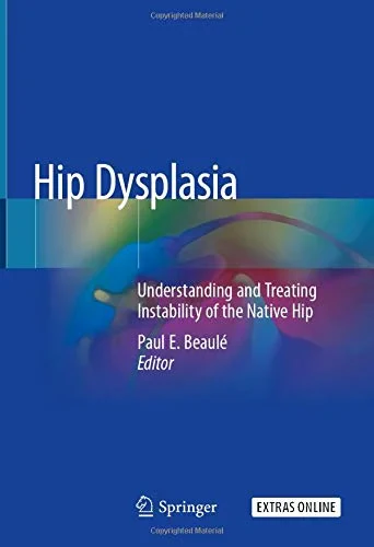 Coperta cărții "Hip Dysplasia: Understanding and Treating Instability of the Native Hip" de Paul E. Beaule
