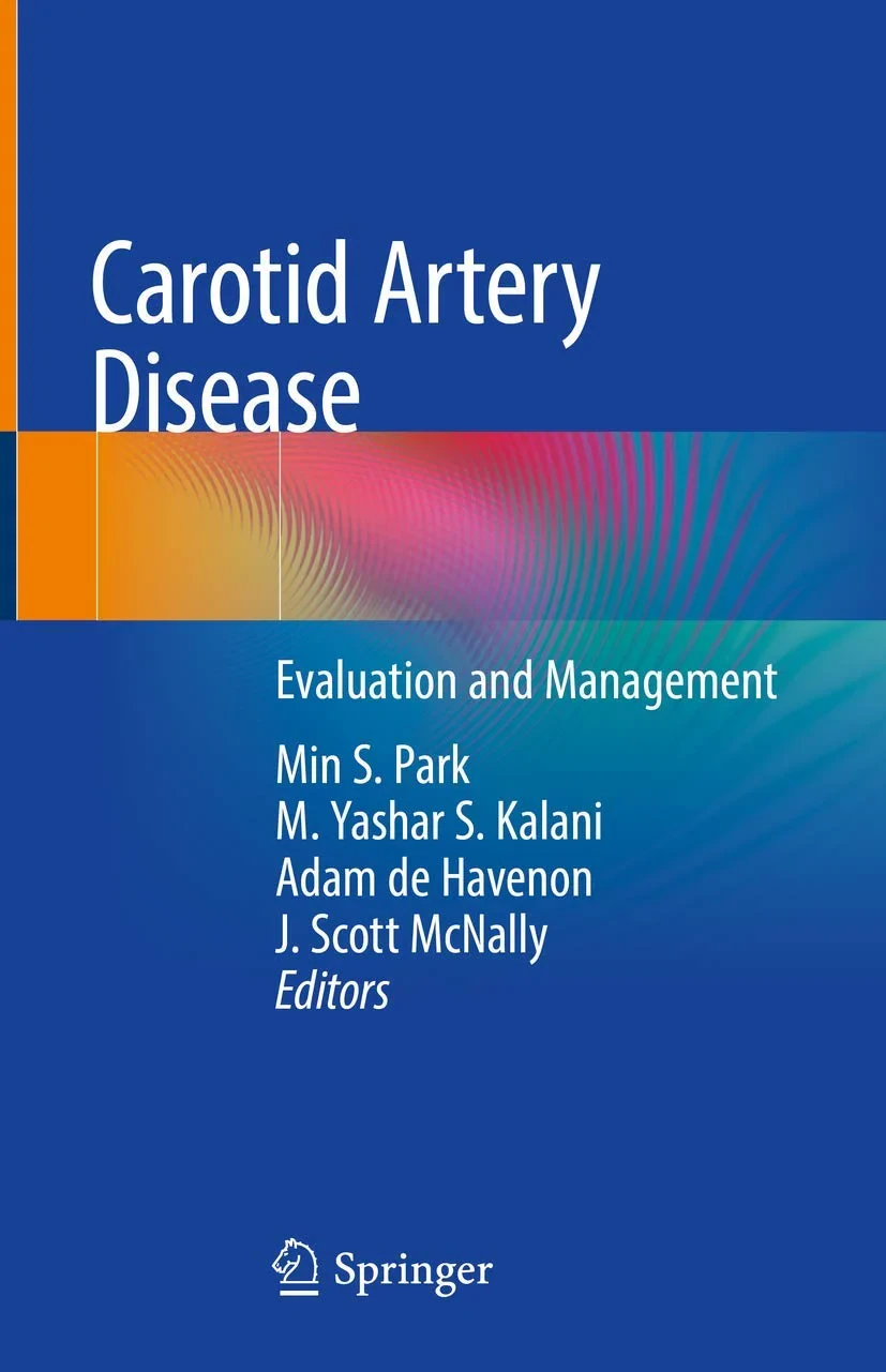 Coperta cărții "Carotid Artery Disease: Evaluation and Management" de M. Yashar S. Kalani, Min S. Park, Adam de Havenon  J. Scott McNally (